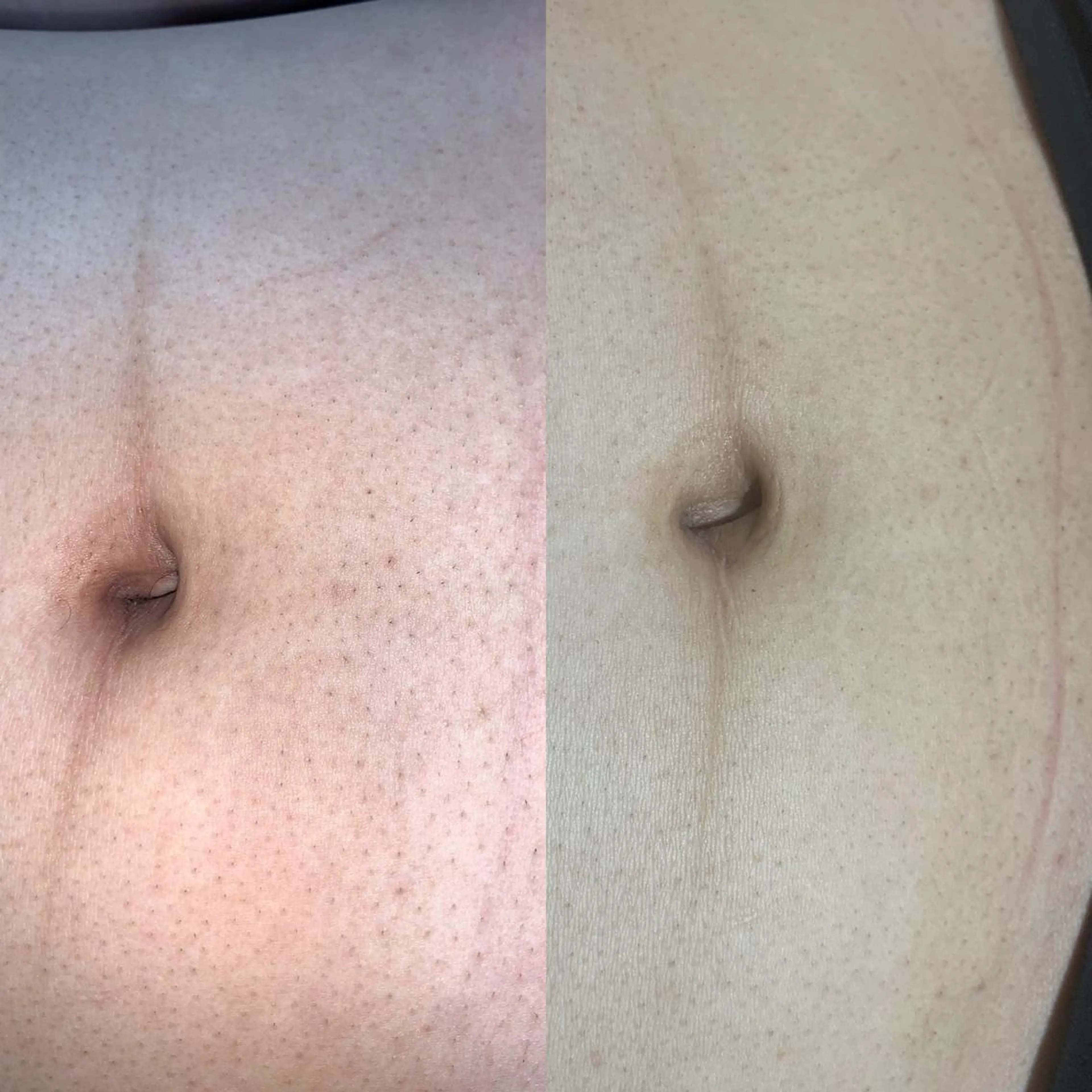 メンズ キッズ 脱毛SALON RaYNiCKのエステ・リラクイメージ