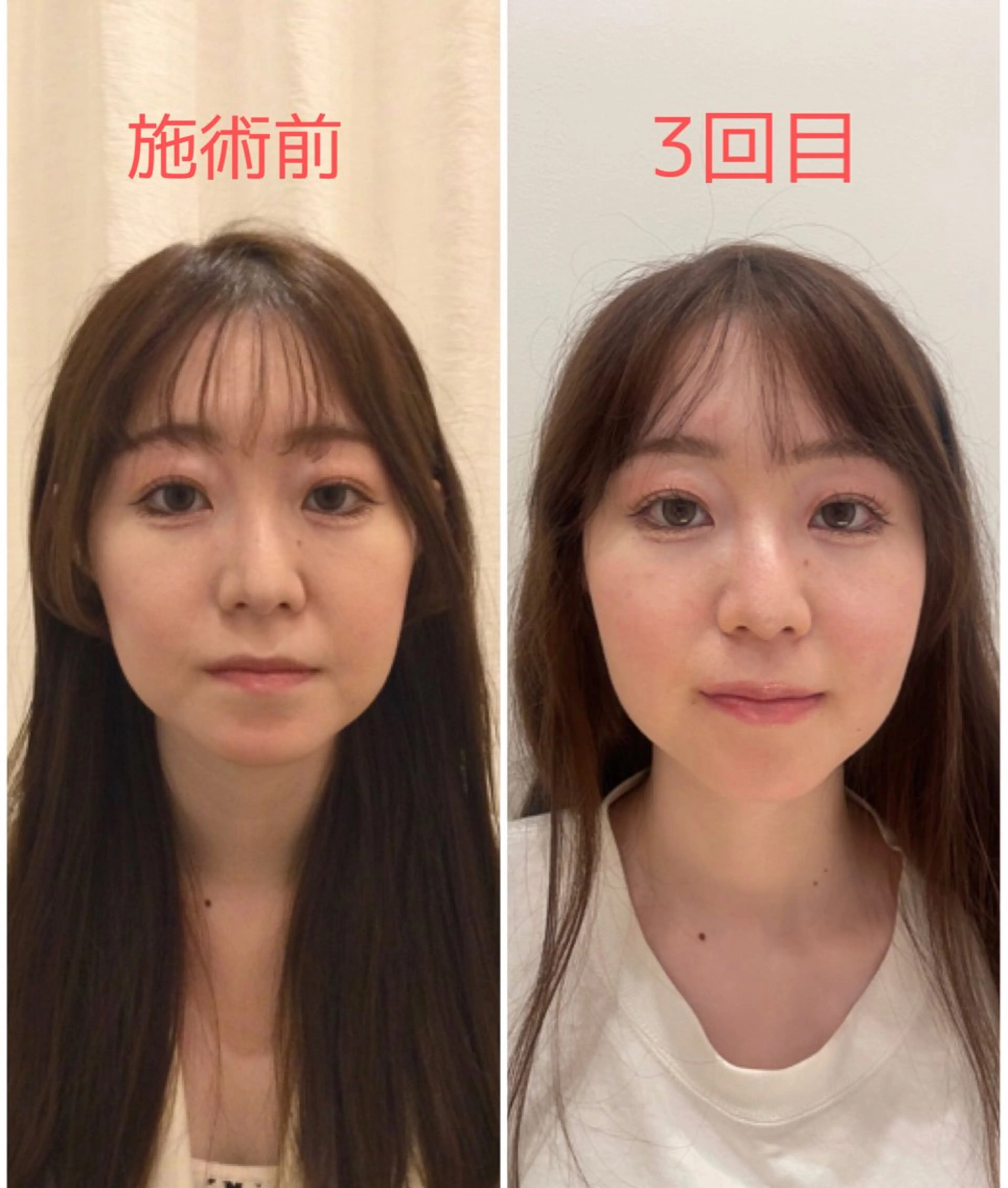 エステ リラク 美容鍼サロンメゾンブランシェ所属・🌸美容鍼サロン🌸 メゾンブランシェ🌈のエステ・リラクイメージ