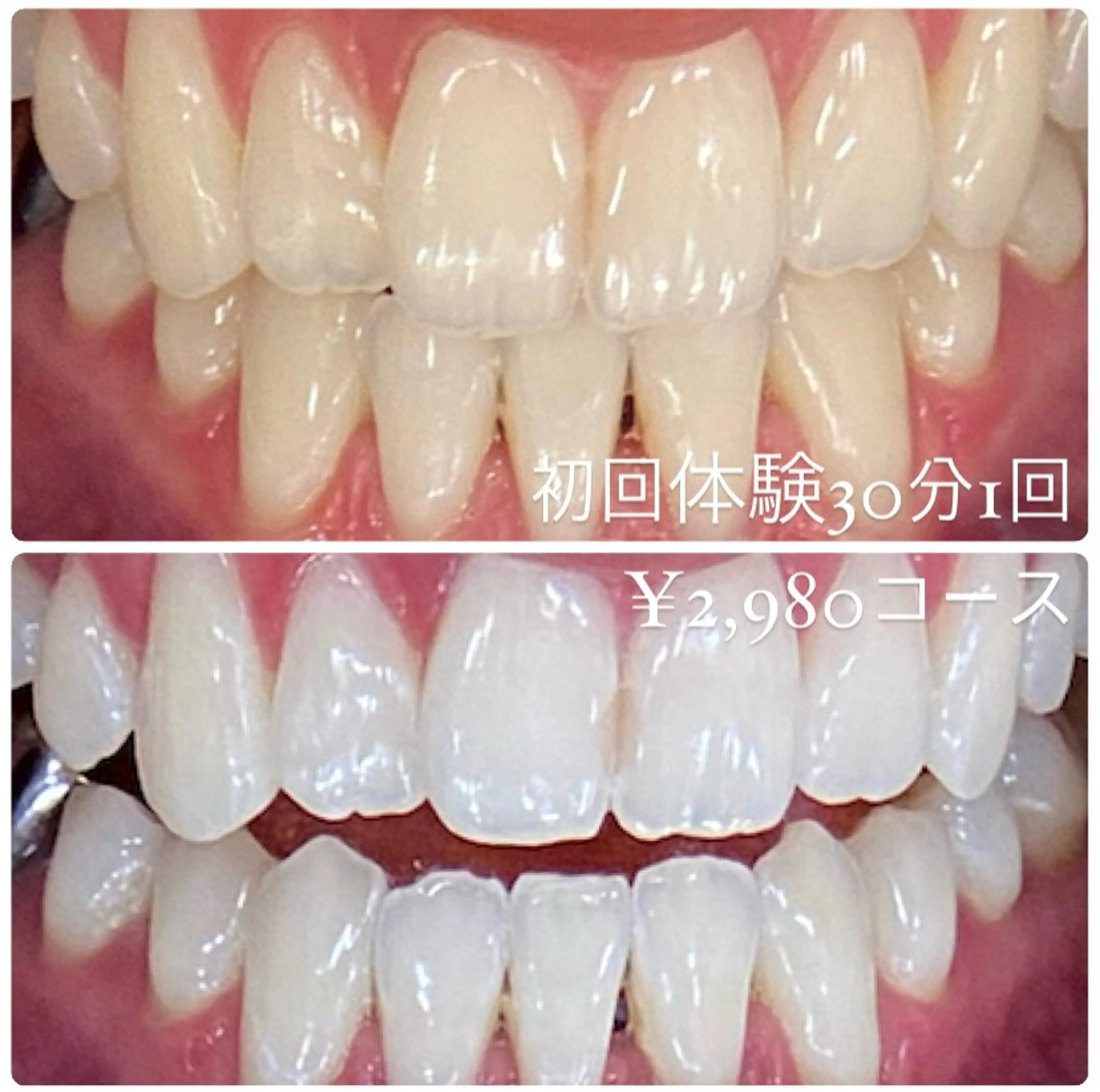 PLATINUM Beauty 横浜店所属・ホワイトニングルーム 横浜店のその他イメージ