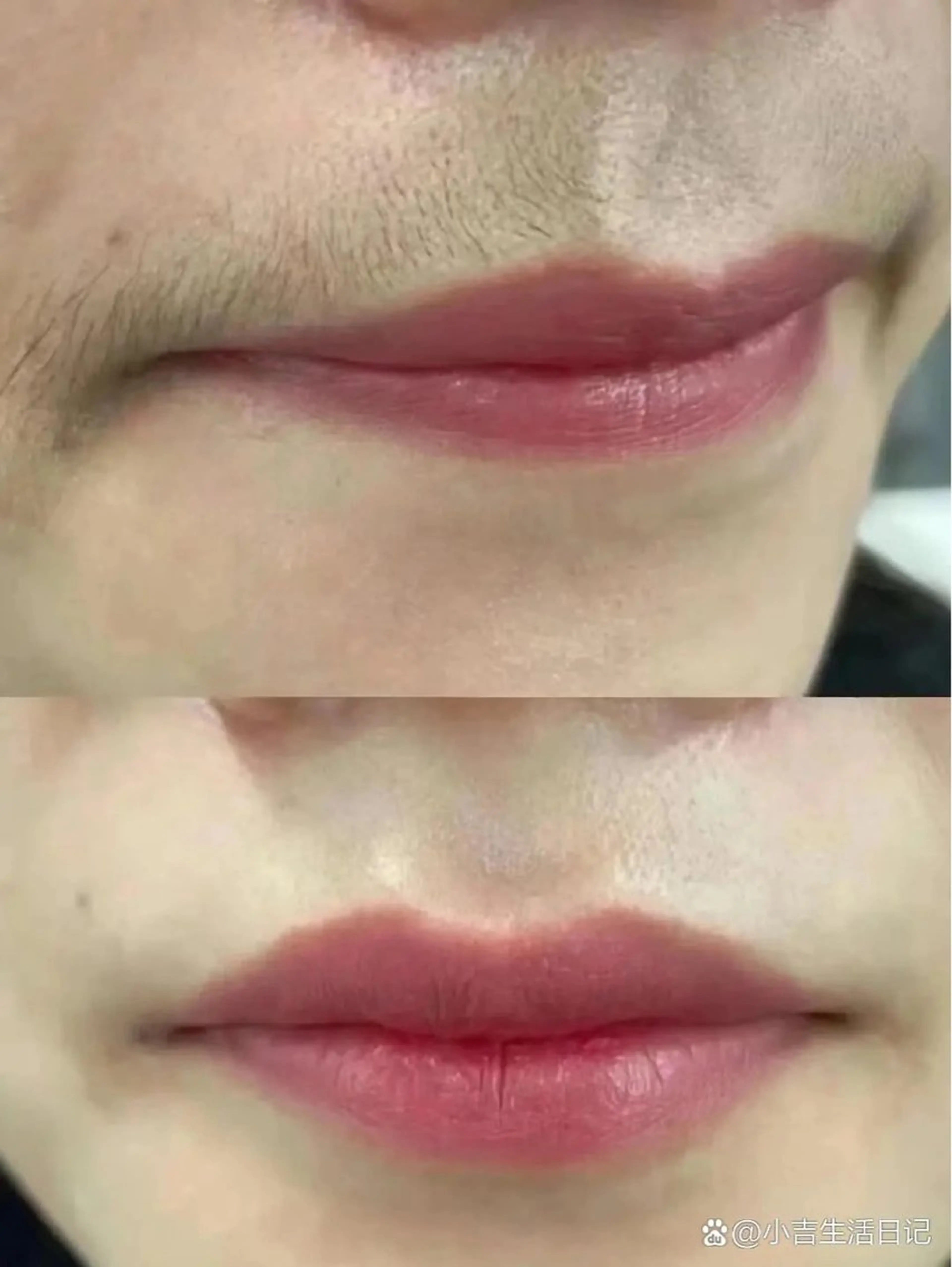 痩身・小顔・脱毛・ オイル&Amourのエステ・リラクイメージ