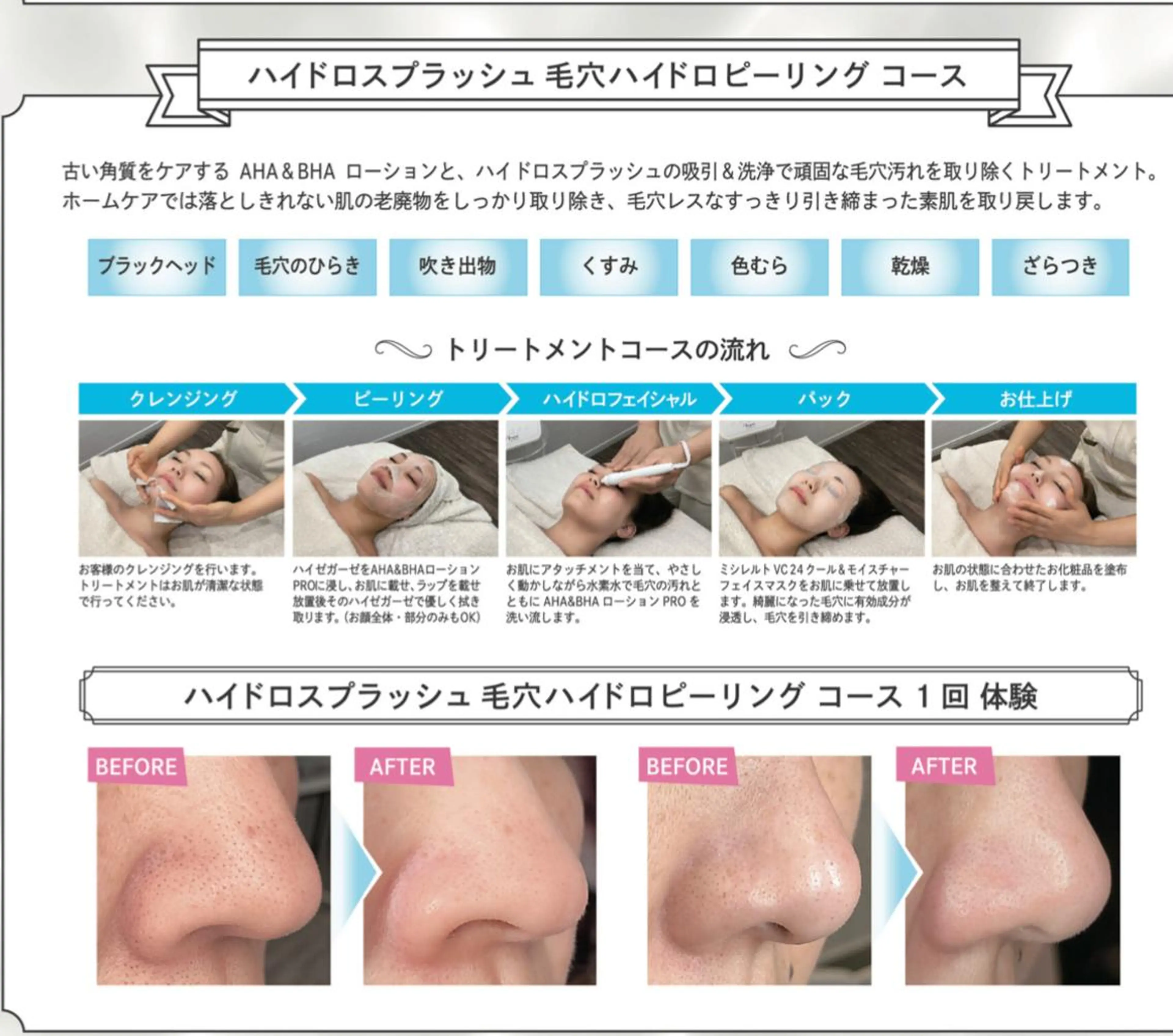 Chalon所属・REVI取扱・肌悩み 毛穴Chalonのエステ・リラクイメージ