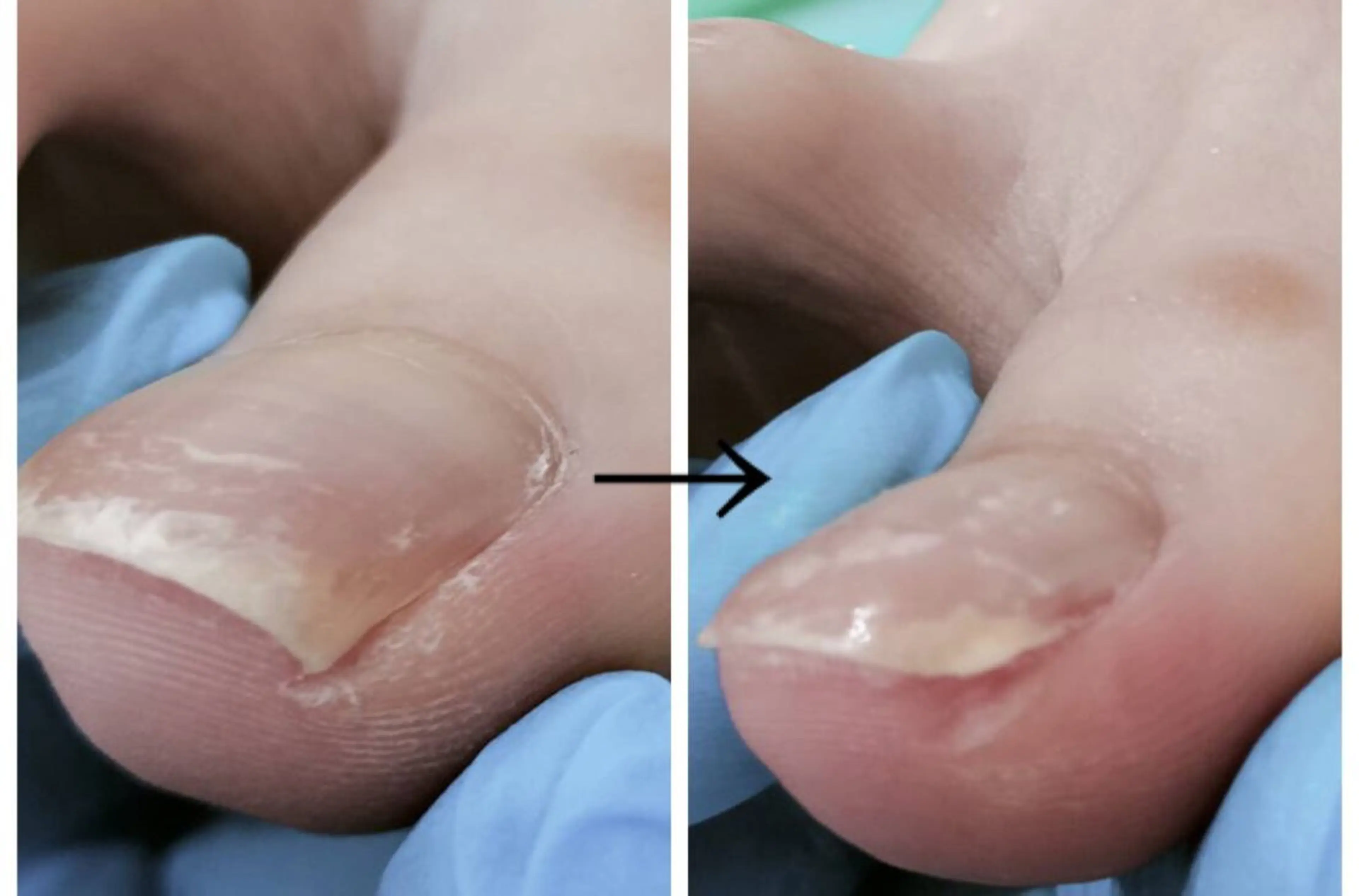 ネイル その他 e.nail所属・和賀井 恵理のネイルデザイン