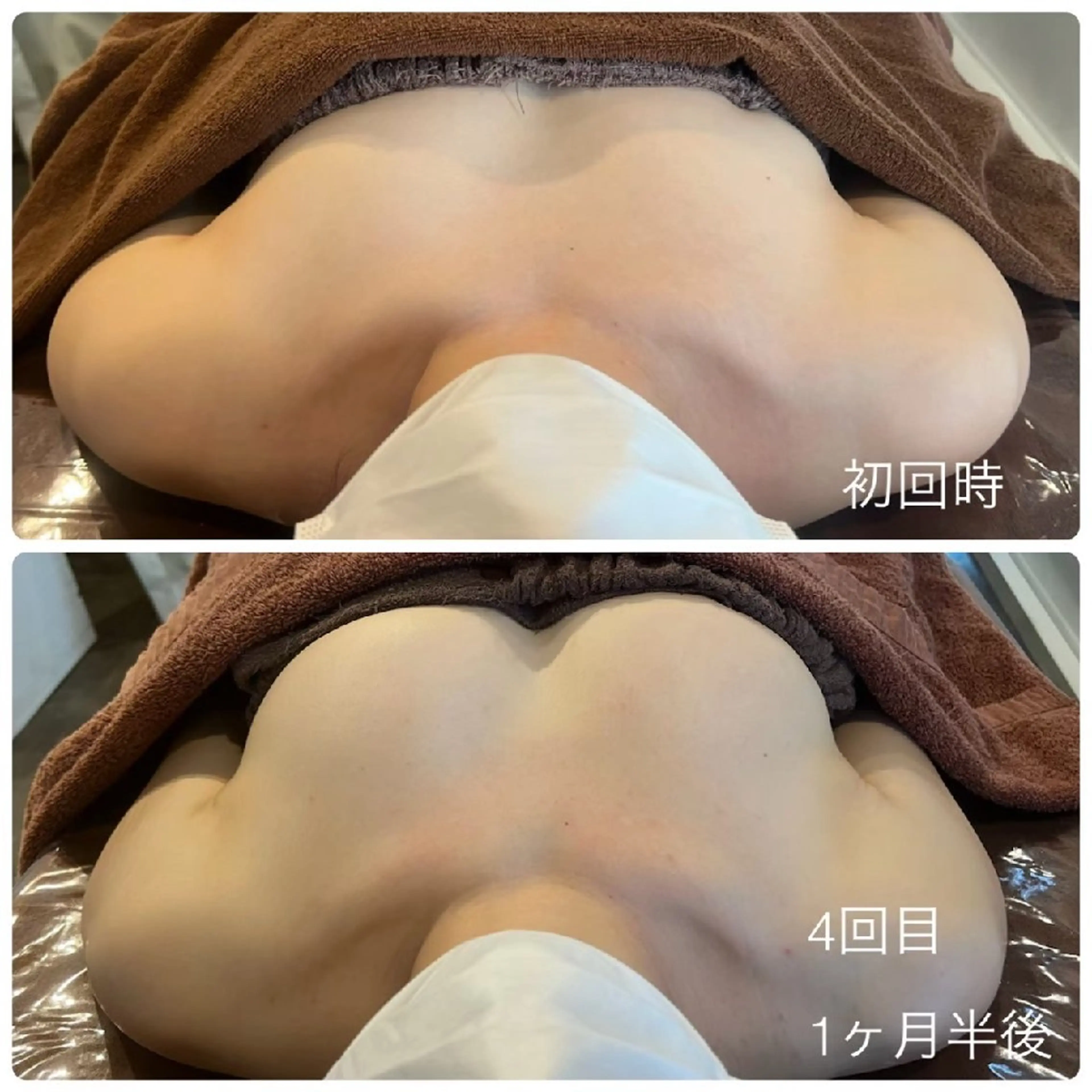 【お時間限定】プレミアム育乳コース☆本気でボリュームアップしたい方☆ハンドマッサージ×生体電流×光豊胸×美容液導入の写真