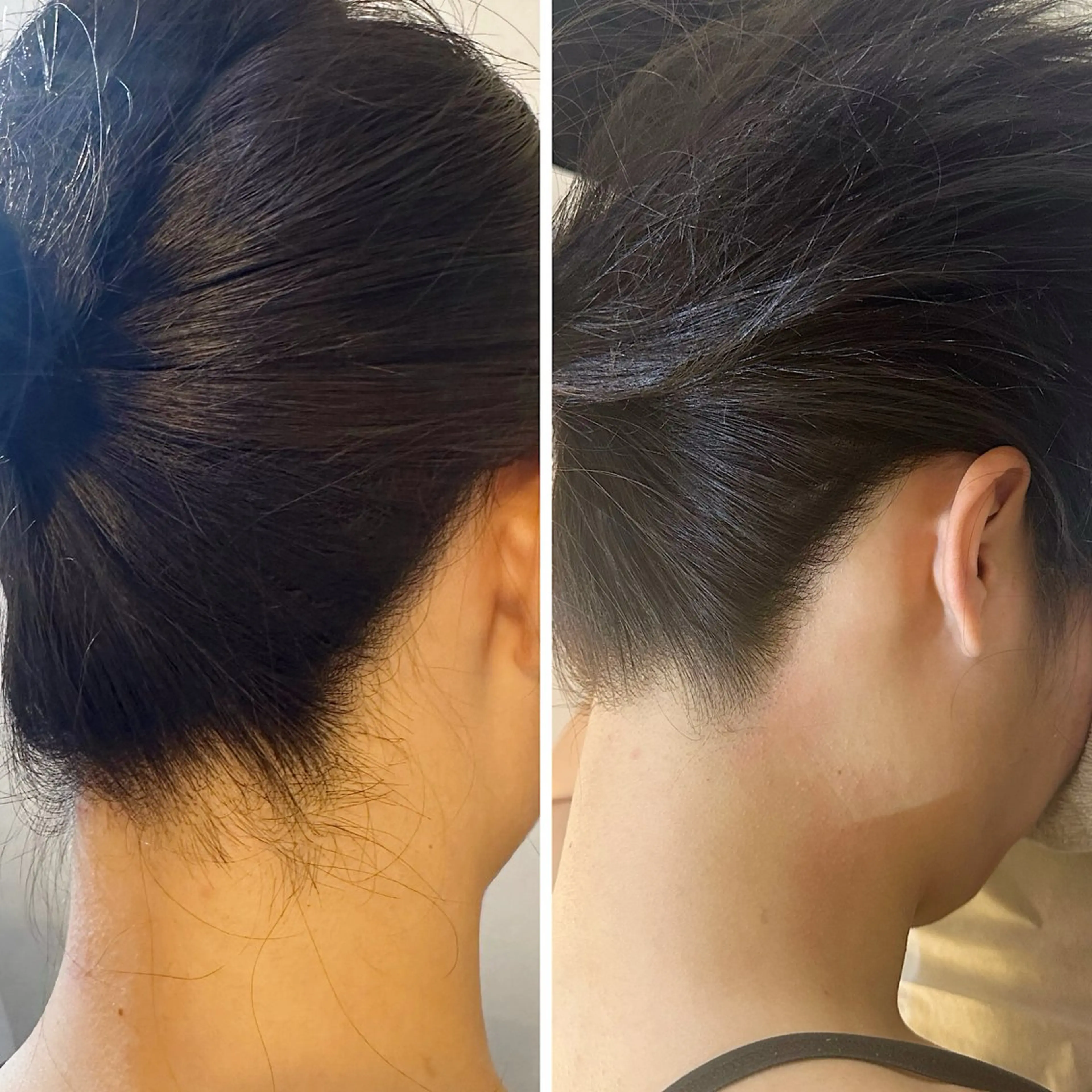 脱毛 うなじ脱毛/美肌脱毛 LABELのエステ・リラクイメージ