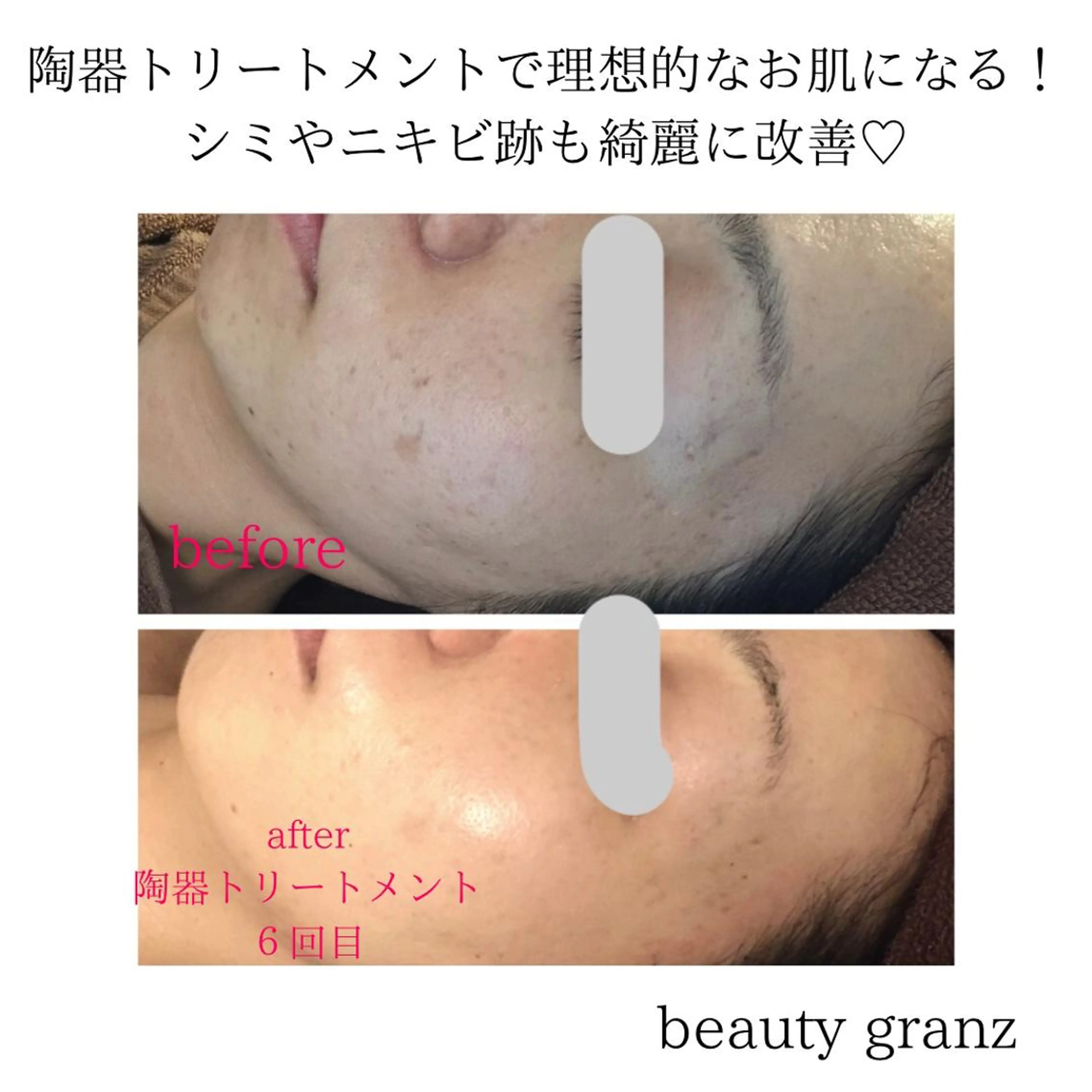 痩身専門サロン ビューティーグランツのエステ・リラクイメージ