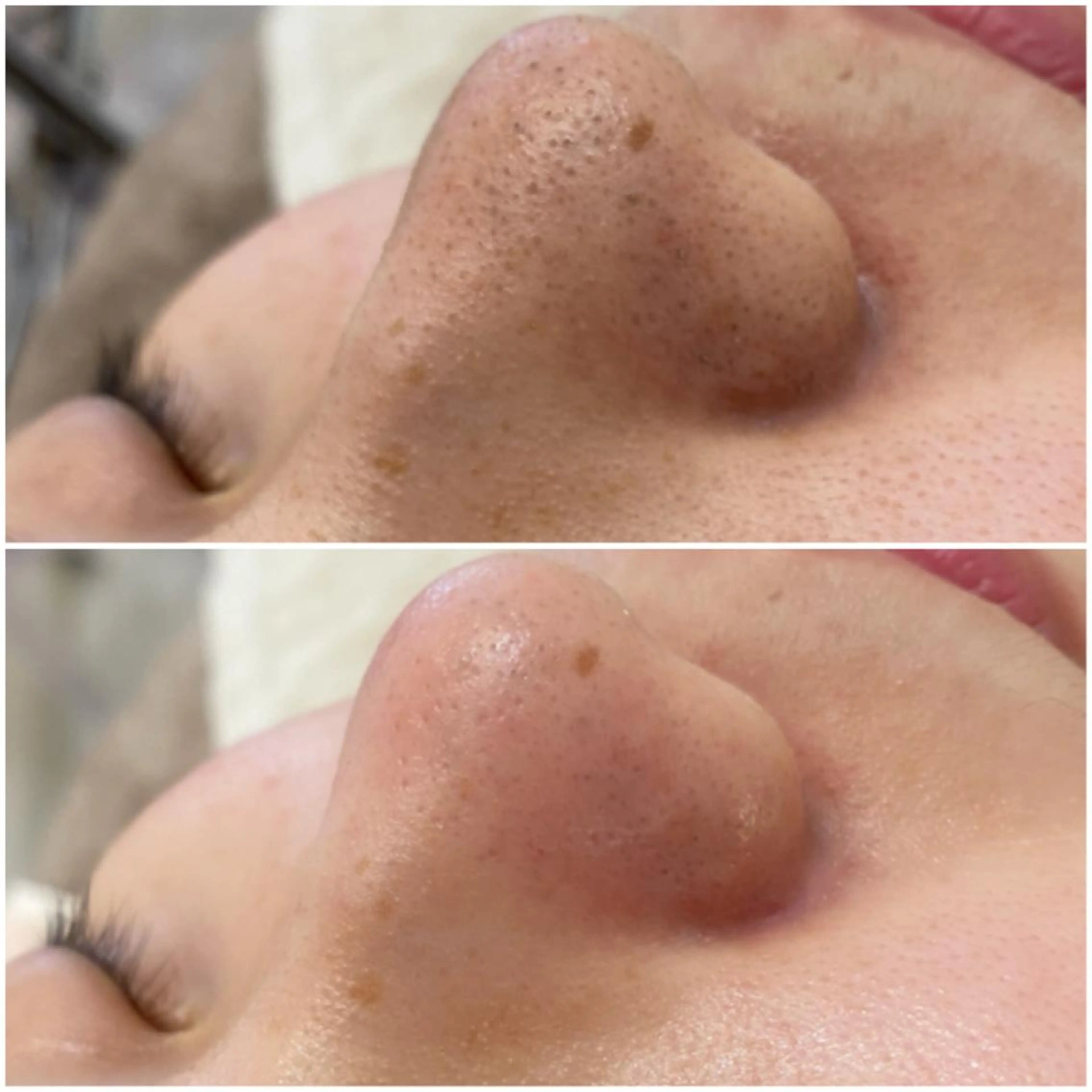 ✨美肌水光✨ アトリエリュバンのエステ・リラクイメージ