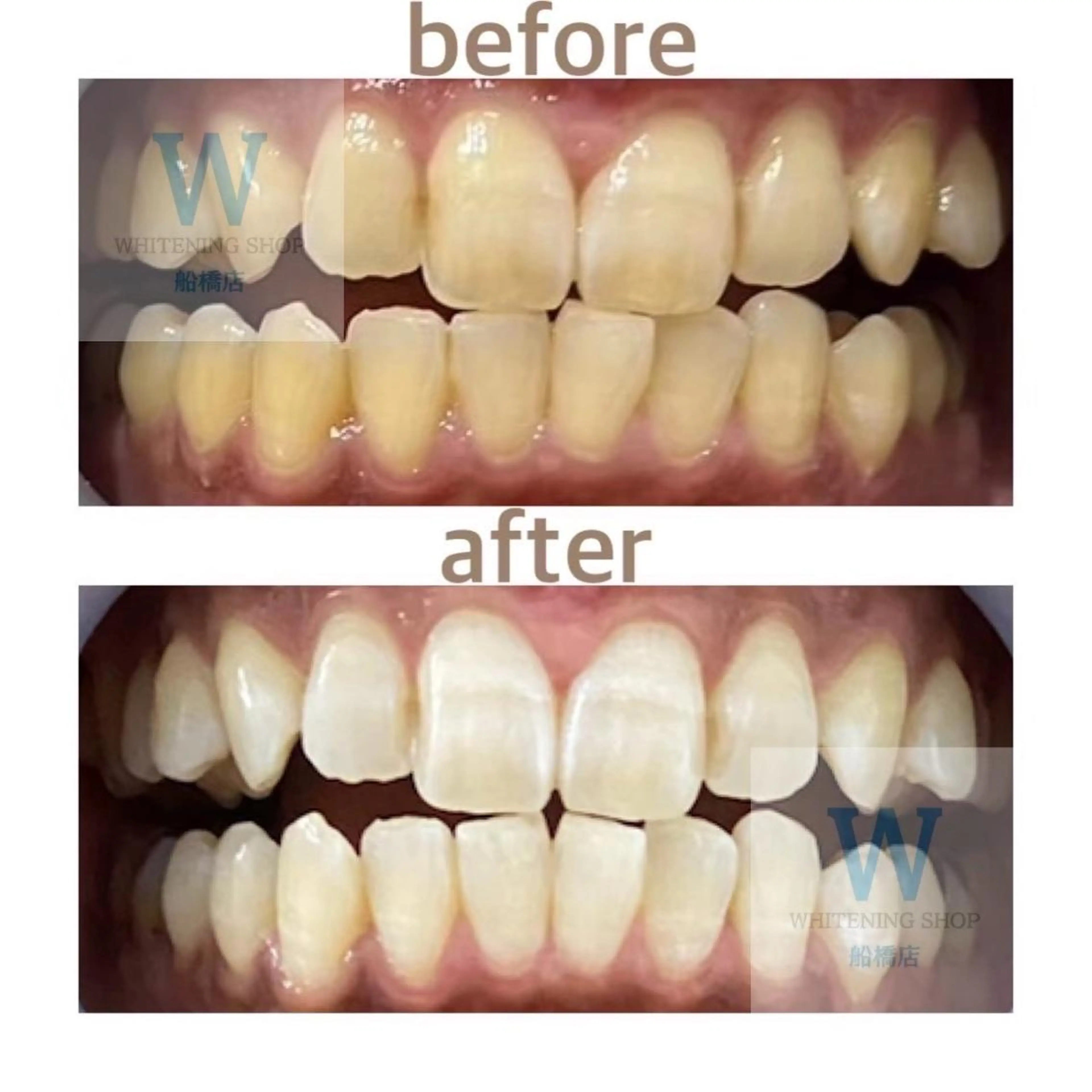 エステ リラク ホワイトニング ショップ船橋２号店のエステ・リラクイメージ