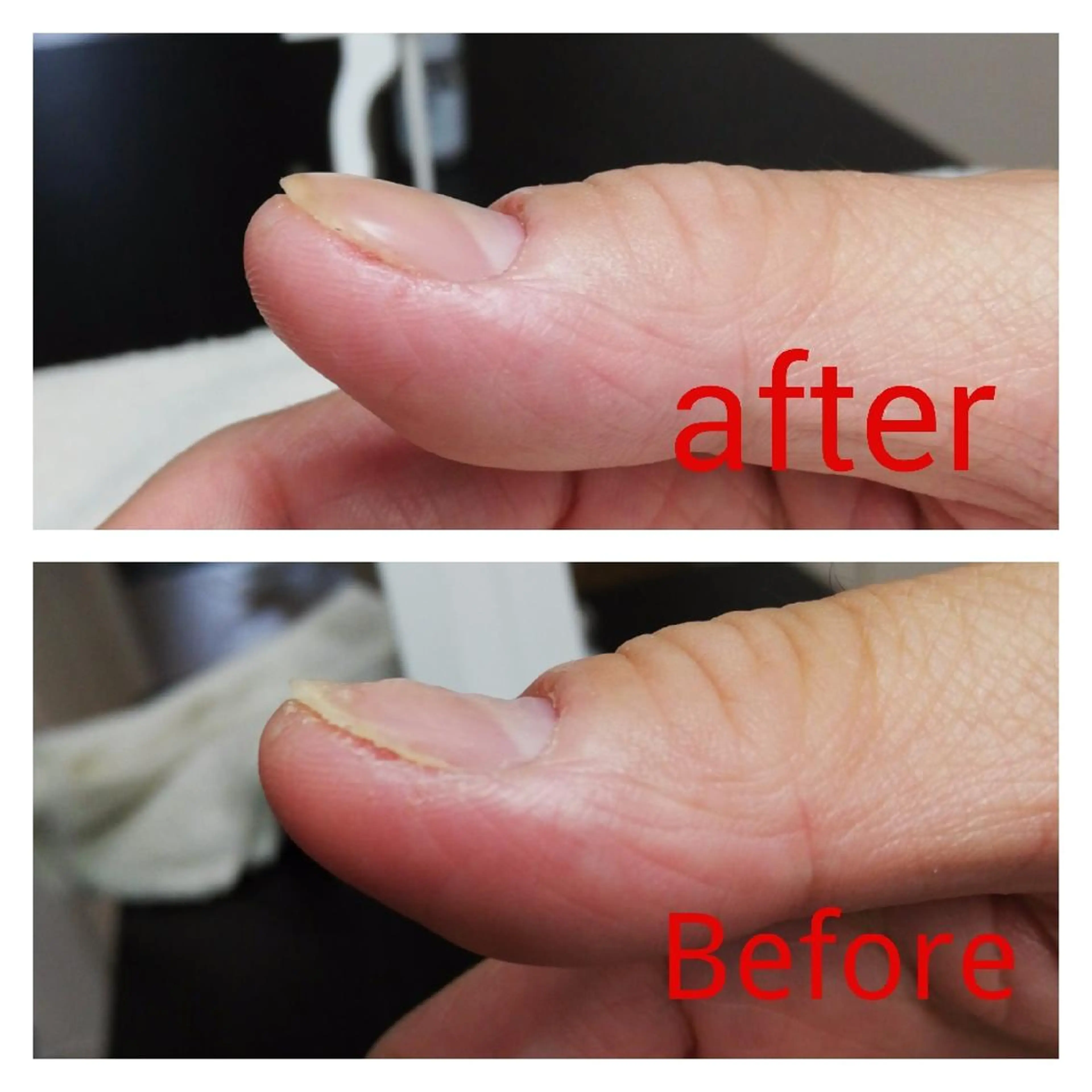 ネイル ハンドネイル 柴崎 美幸のネイルデザイン