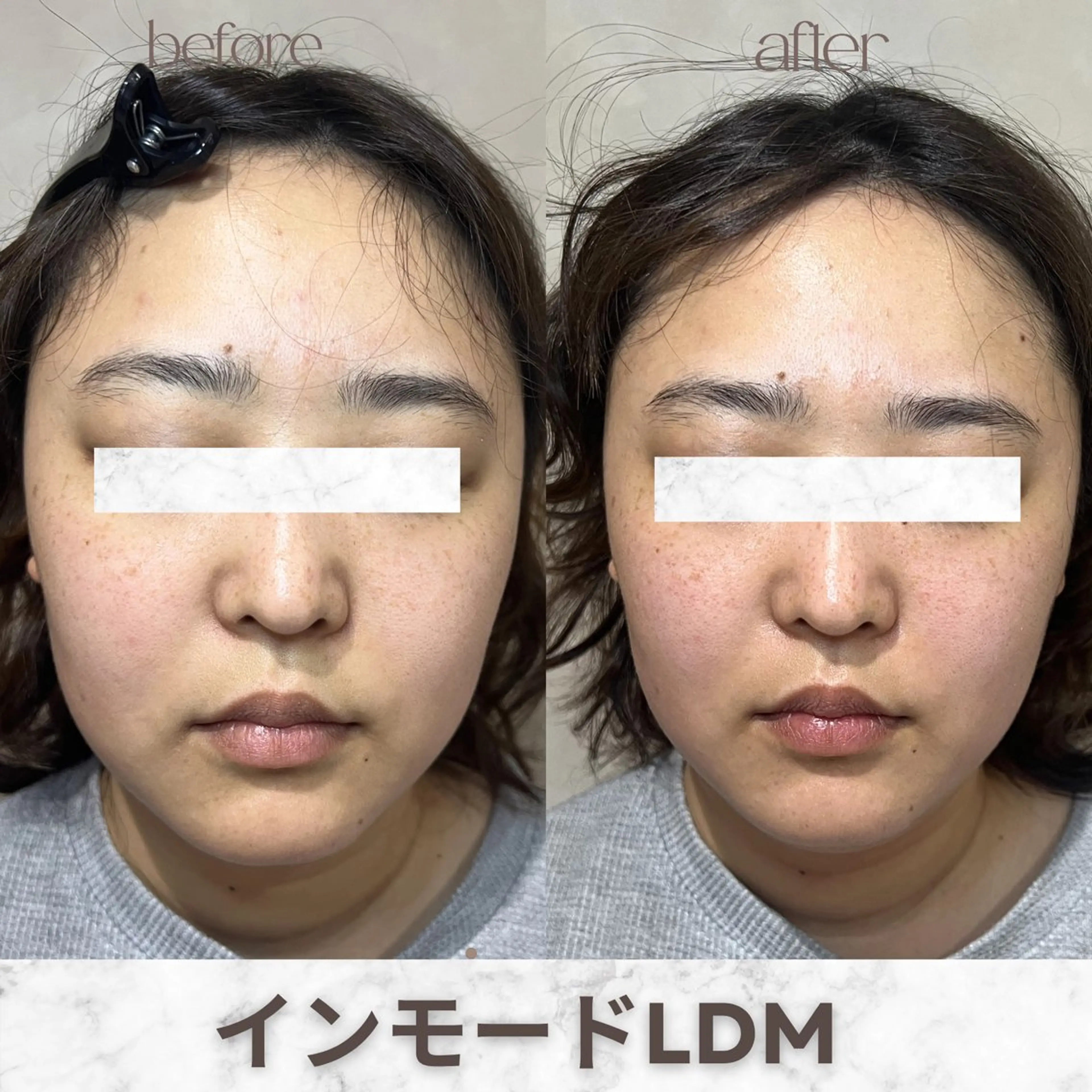 エステ aimer 服部のその他イメージ