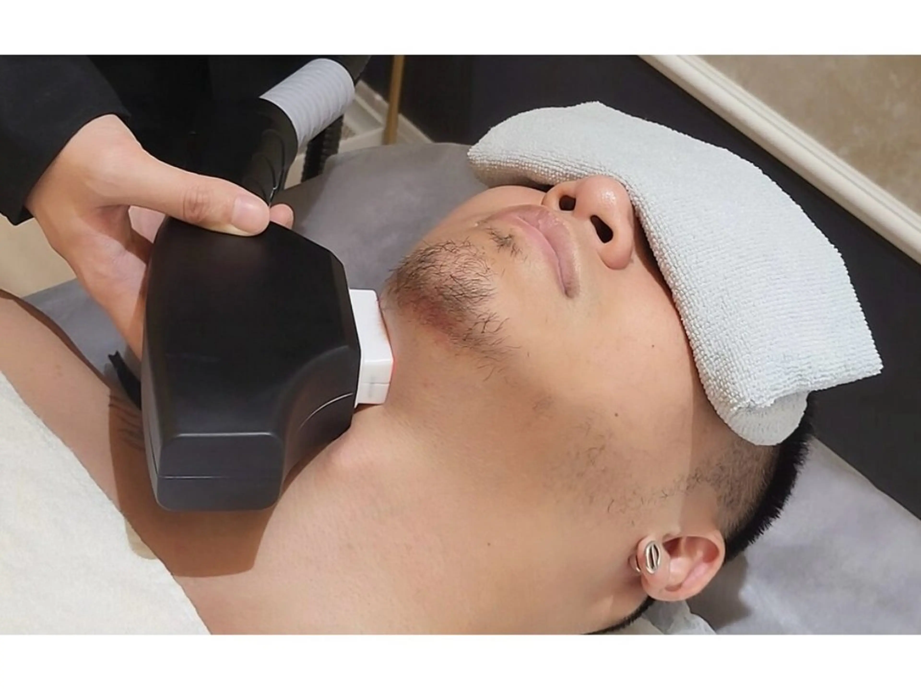 【何度でも同価格】お顔全体メンズ髭脱毛☆毎日の髭剃りから解放 ¥3,500の写真