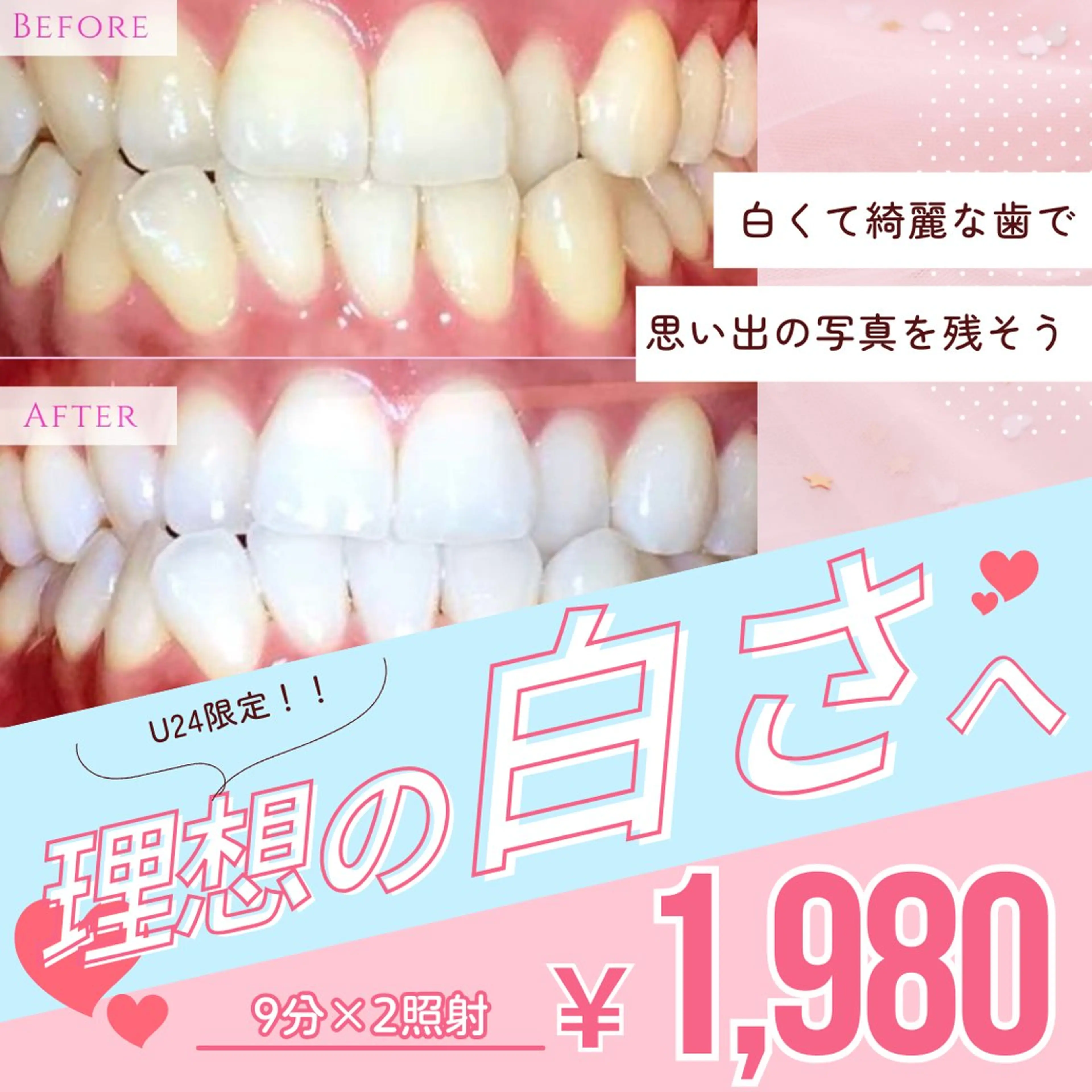 その他 エクシアホワイト調布所属・aoi❤︎ ホワイトニングのその他イメージ