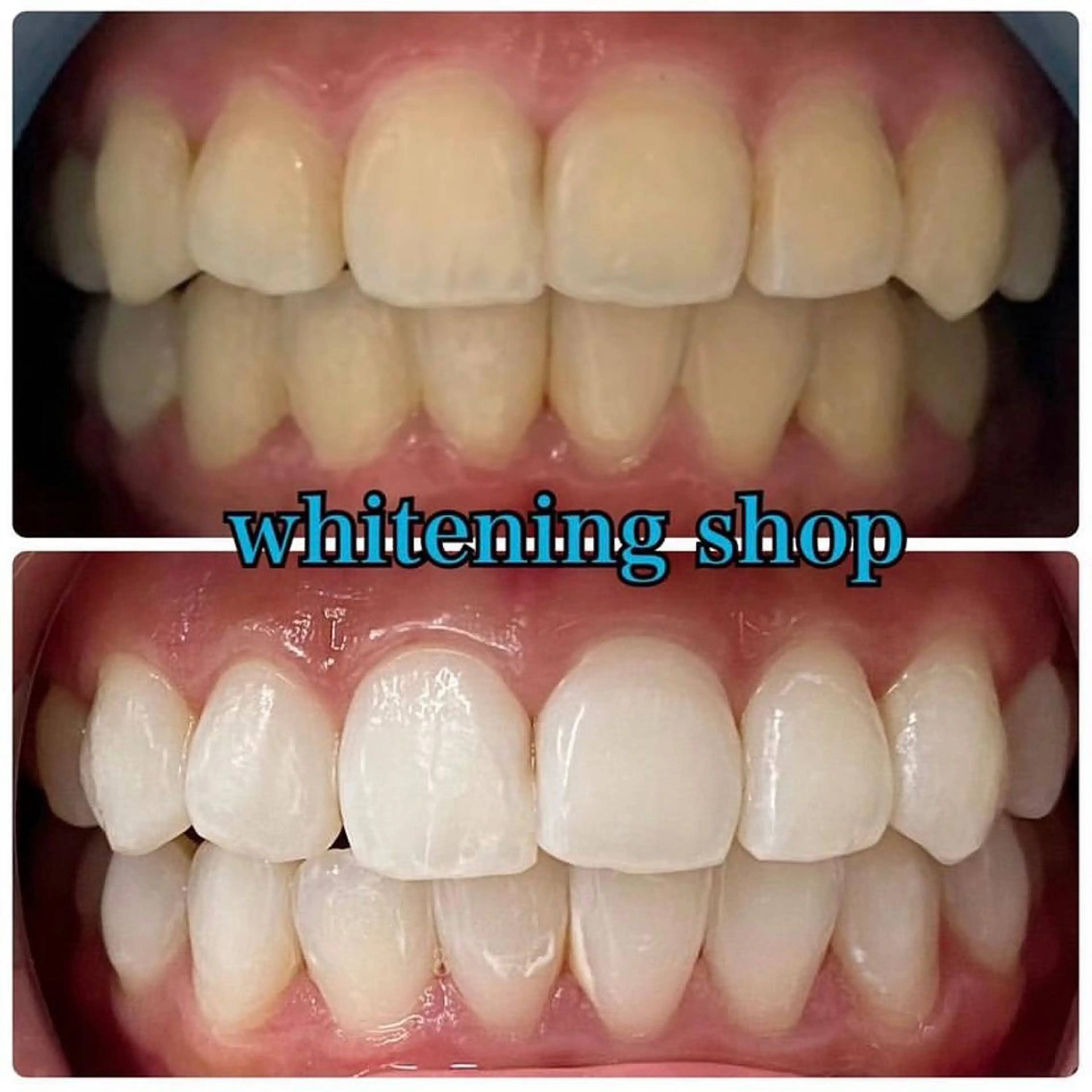 ホワイトニング ショップ吉祥寺店のエステ・リラクイメージ