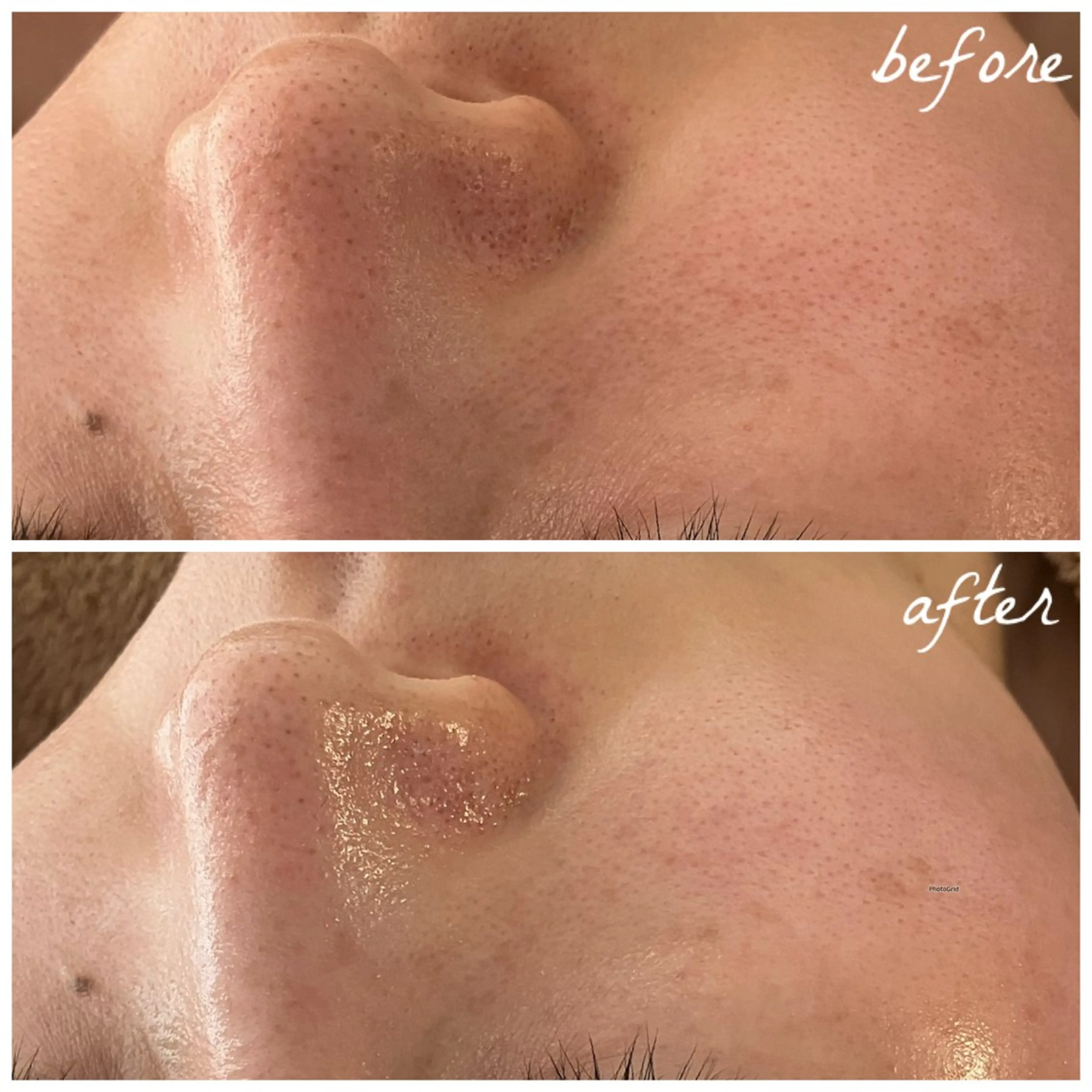 メンズ エステ メナード岐阜茜部 杉浦のエステ・リラクイメージ