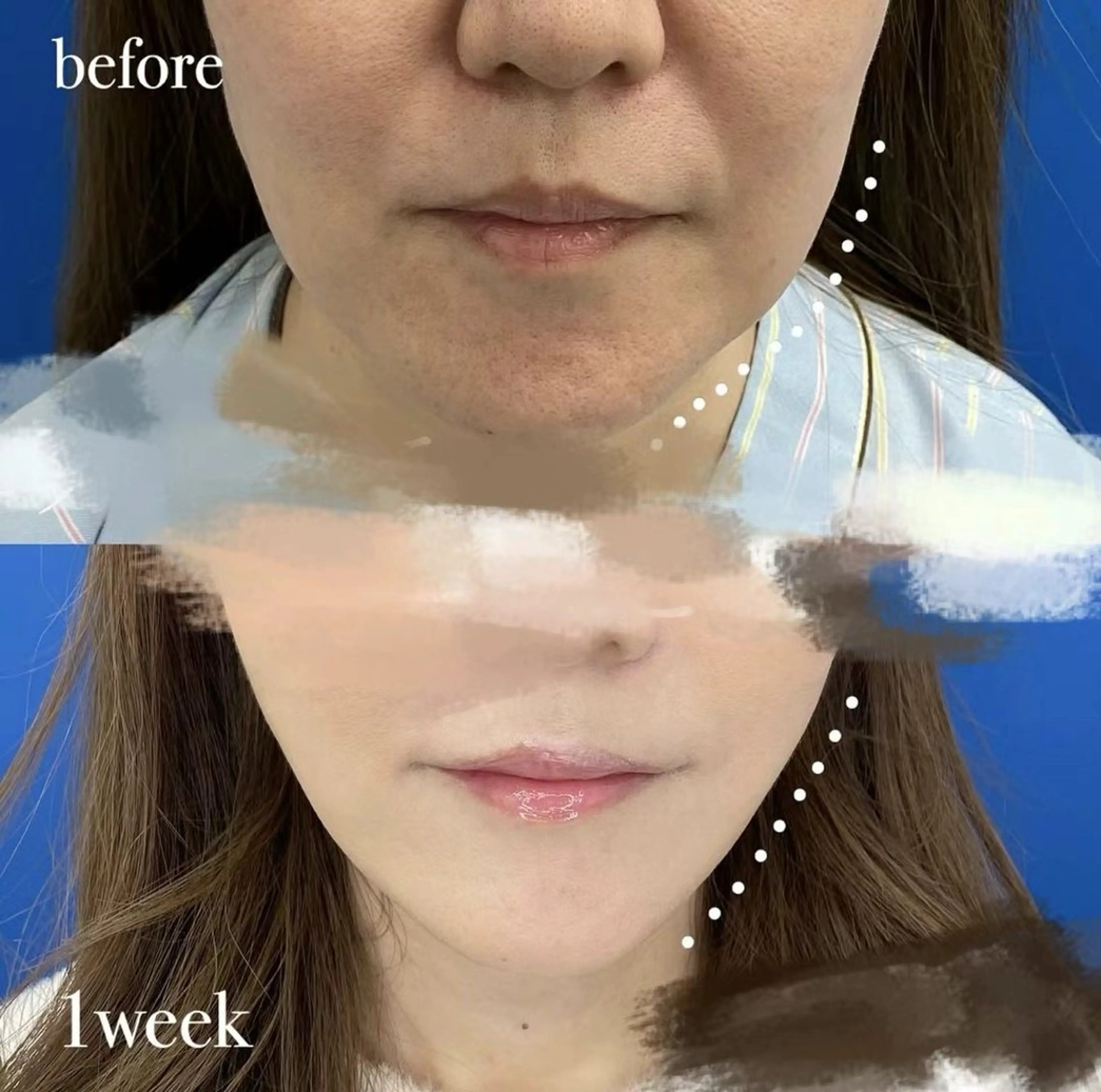 ショート エステ aliaハイフ&水光ジェットサロン所属・aliaハーブ水光店 エステティシャン募集のエステ・リラクイメージ