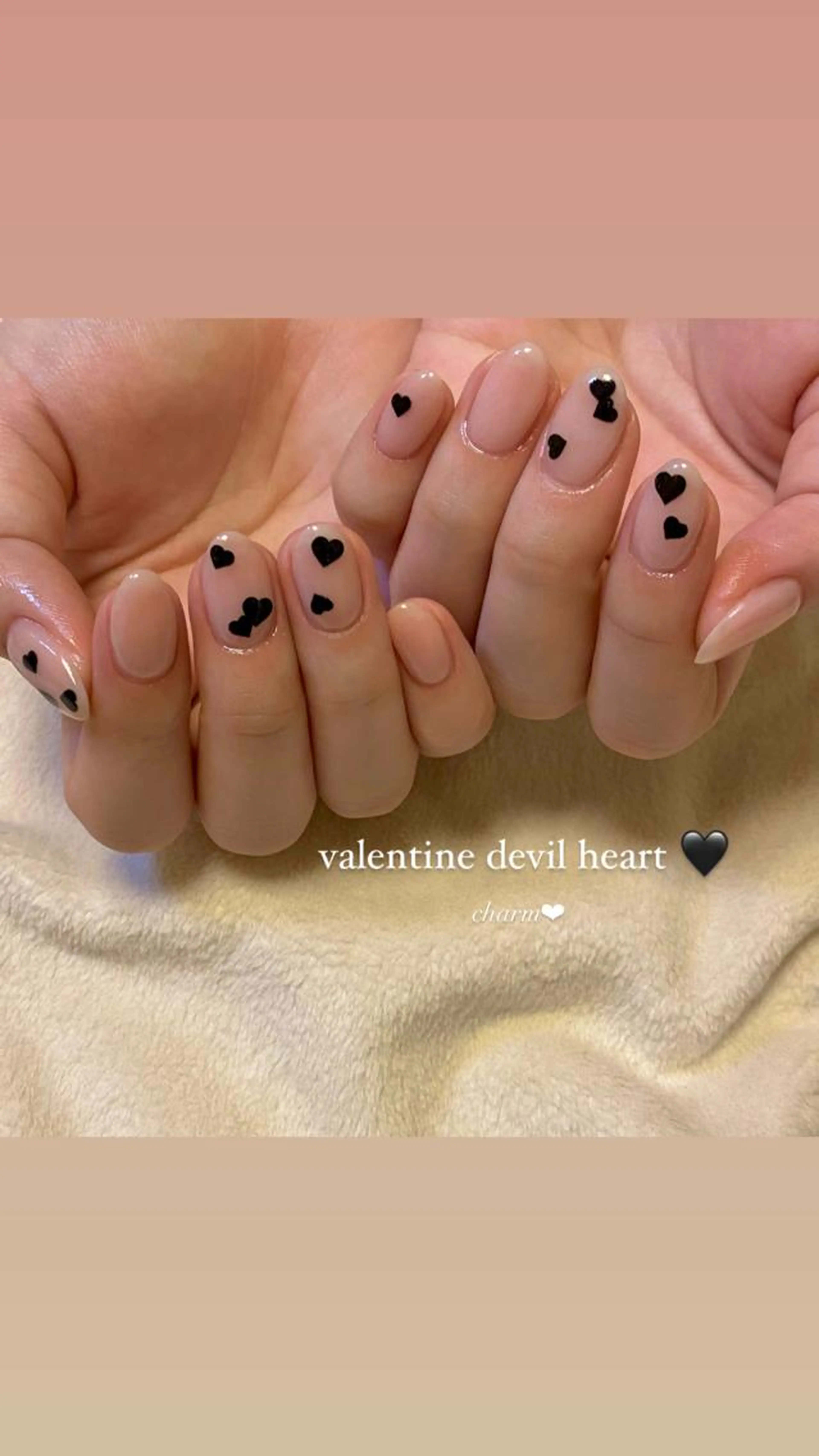 〖ピールオフ〗 アート5本 (オフ・ケア込 / 他店オフOK)の写真