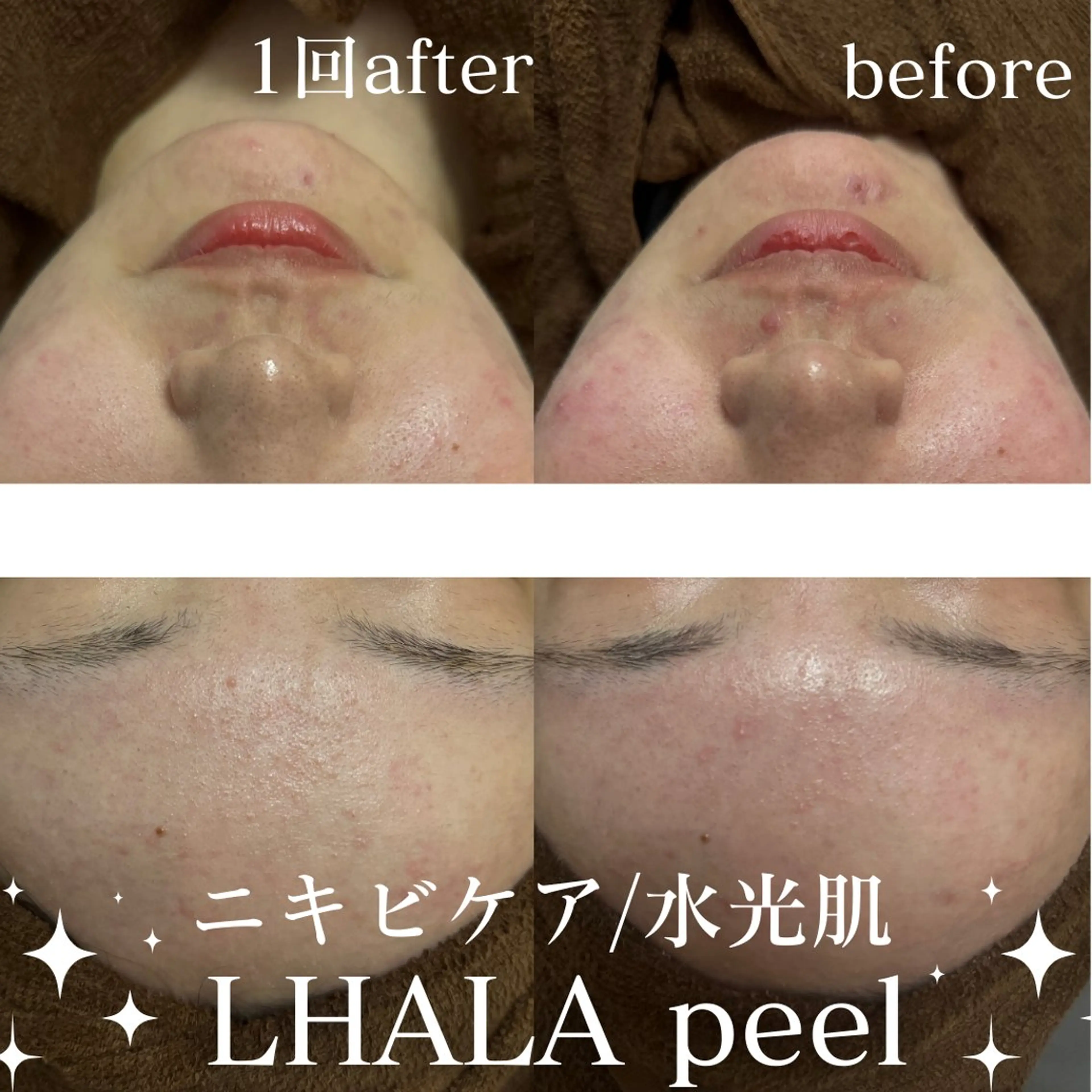 エステ 美肌salon GRAN CUORE所属・Natsuki🌙 GRAN CUOREのエステ・リラクイメージ