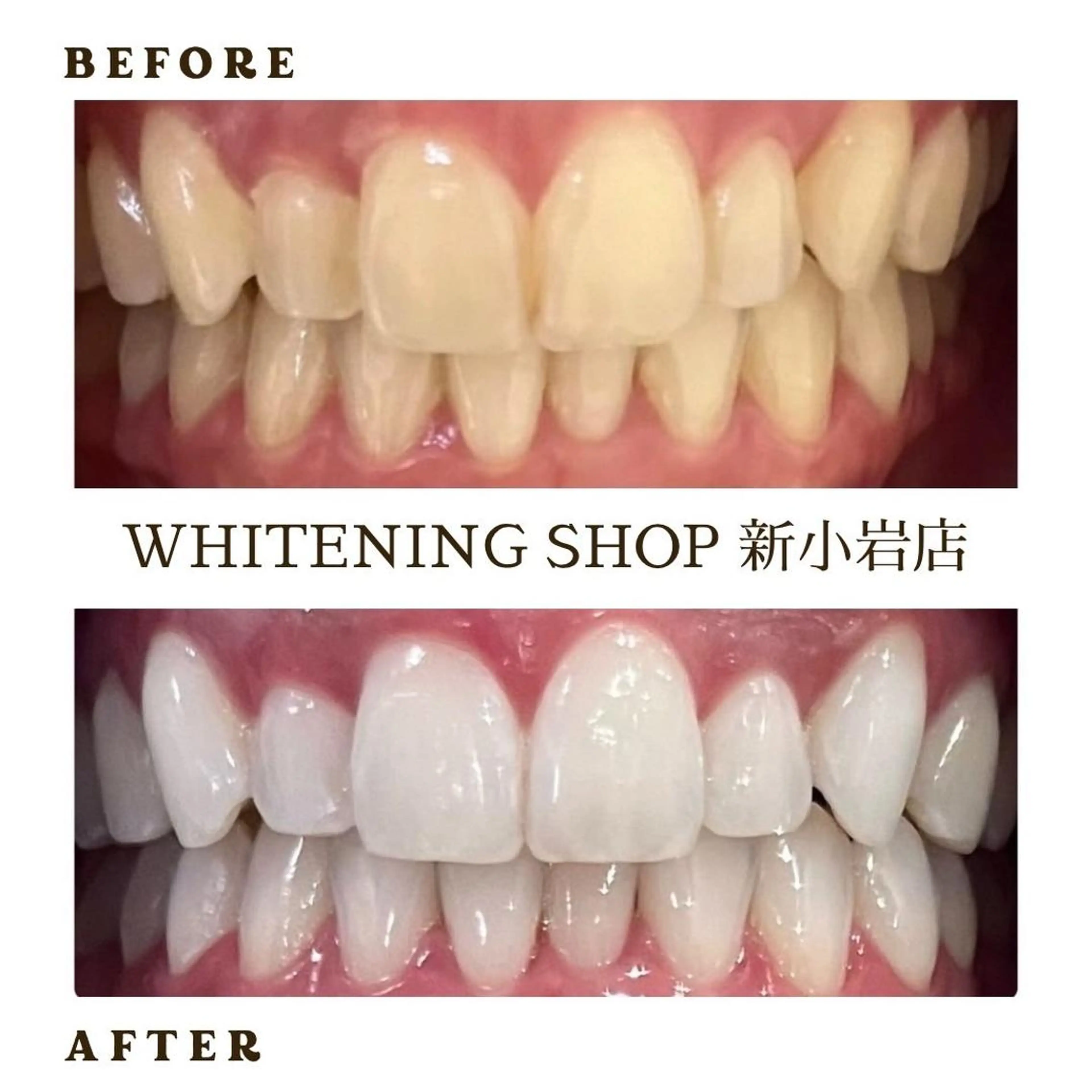 メンズ その他 ホワイトニング ショップ新小岩店のその他イメージ