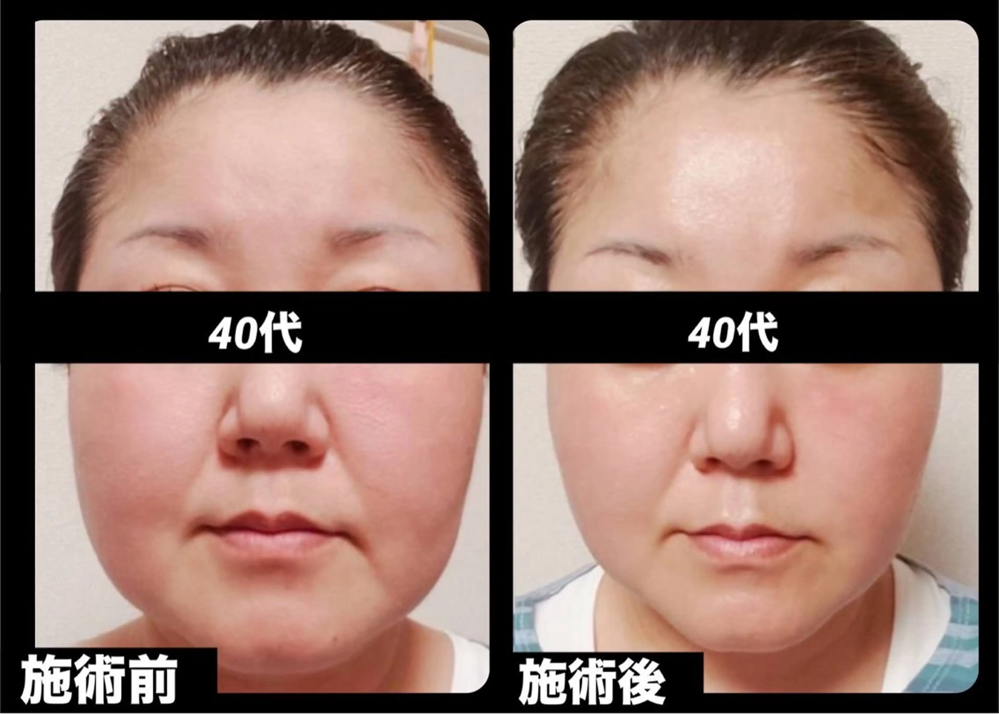 夜エステサロン🌷Luana所属・夜サロン♡ Luana🦋.*˚のエステ・リラクイメージ