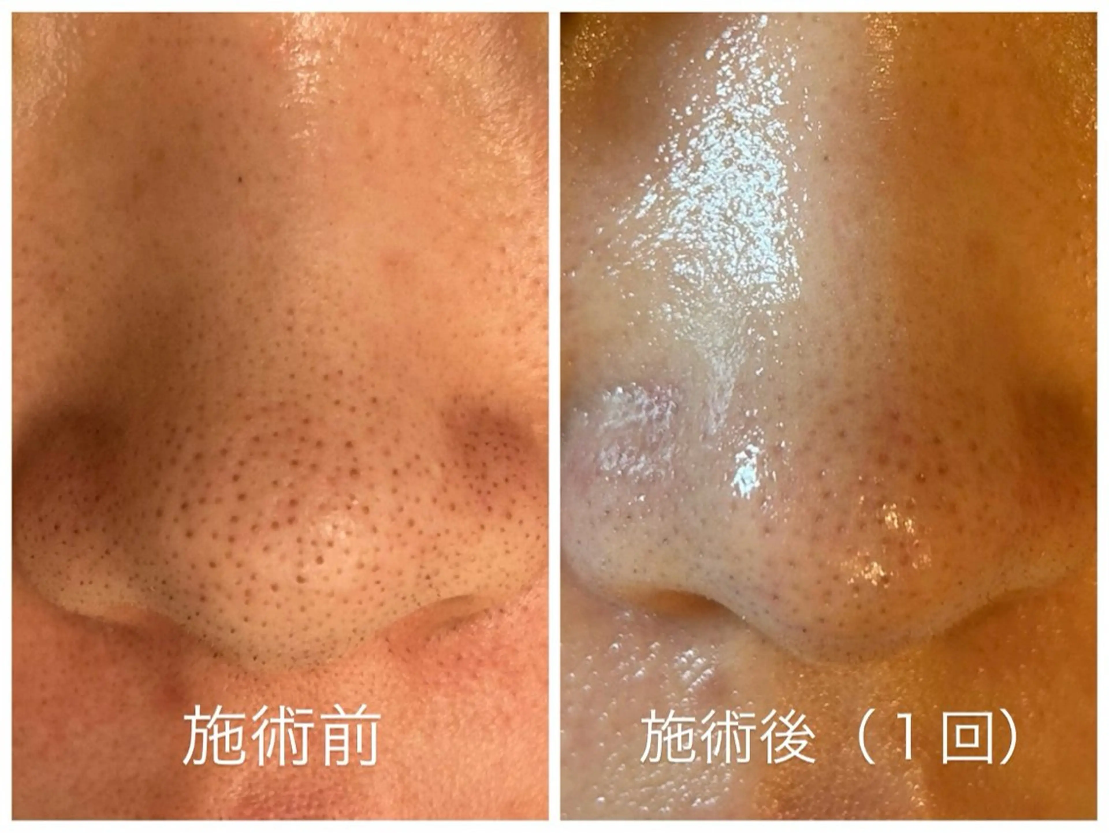 【都度払い脱毛 美肌脱毛】馬車道店のエステ・リラクイメージ