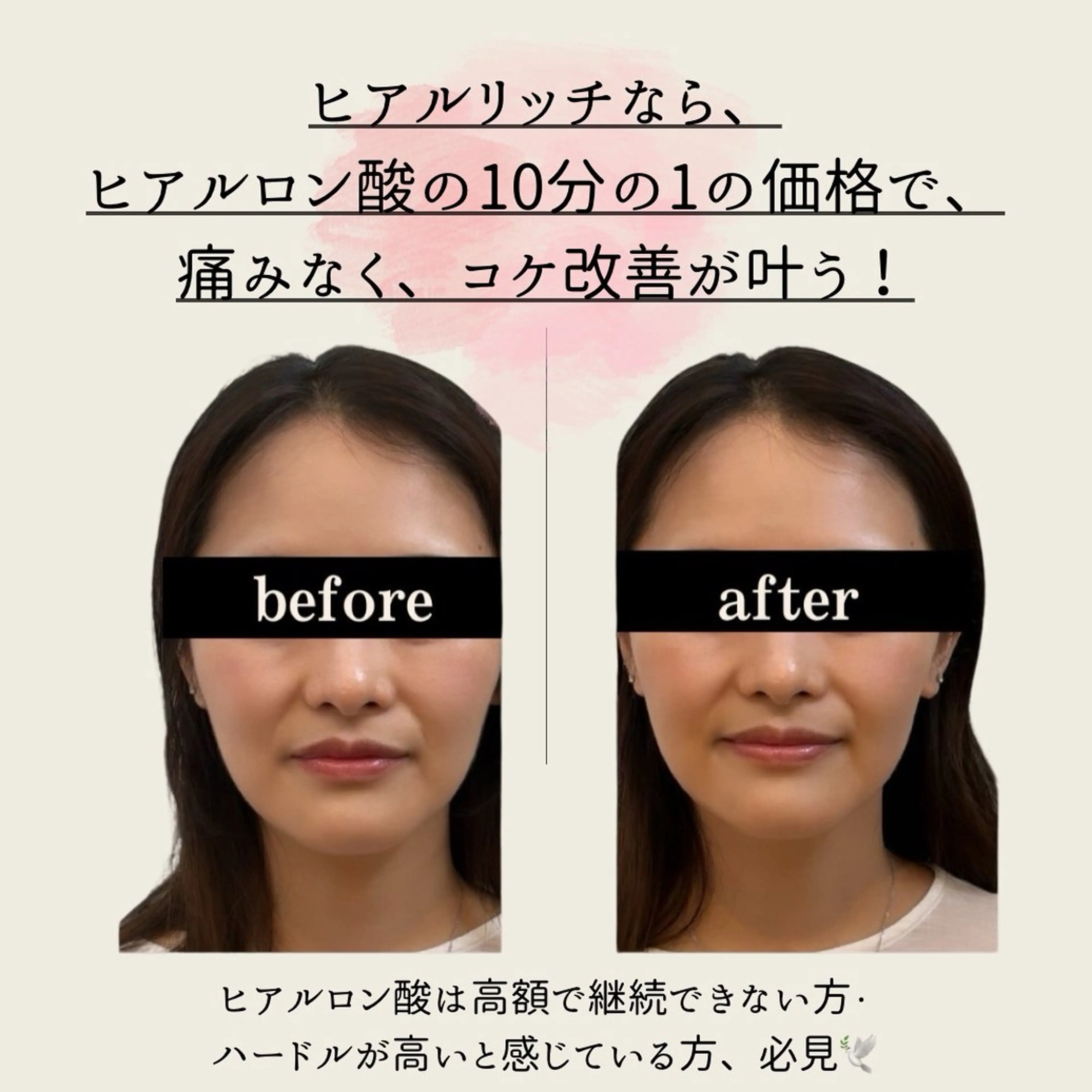 小顔/たるみ/黒ずみ除去専門サロン/SONA 大和西大寺店所属・【小顔専門看護師 サロンSONA】のエステ・リラクイメージ