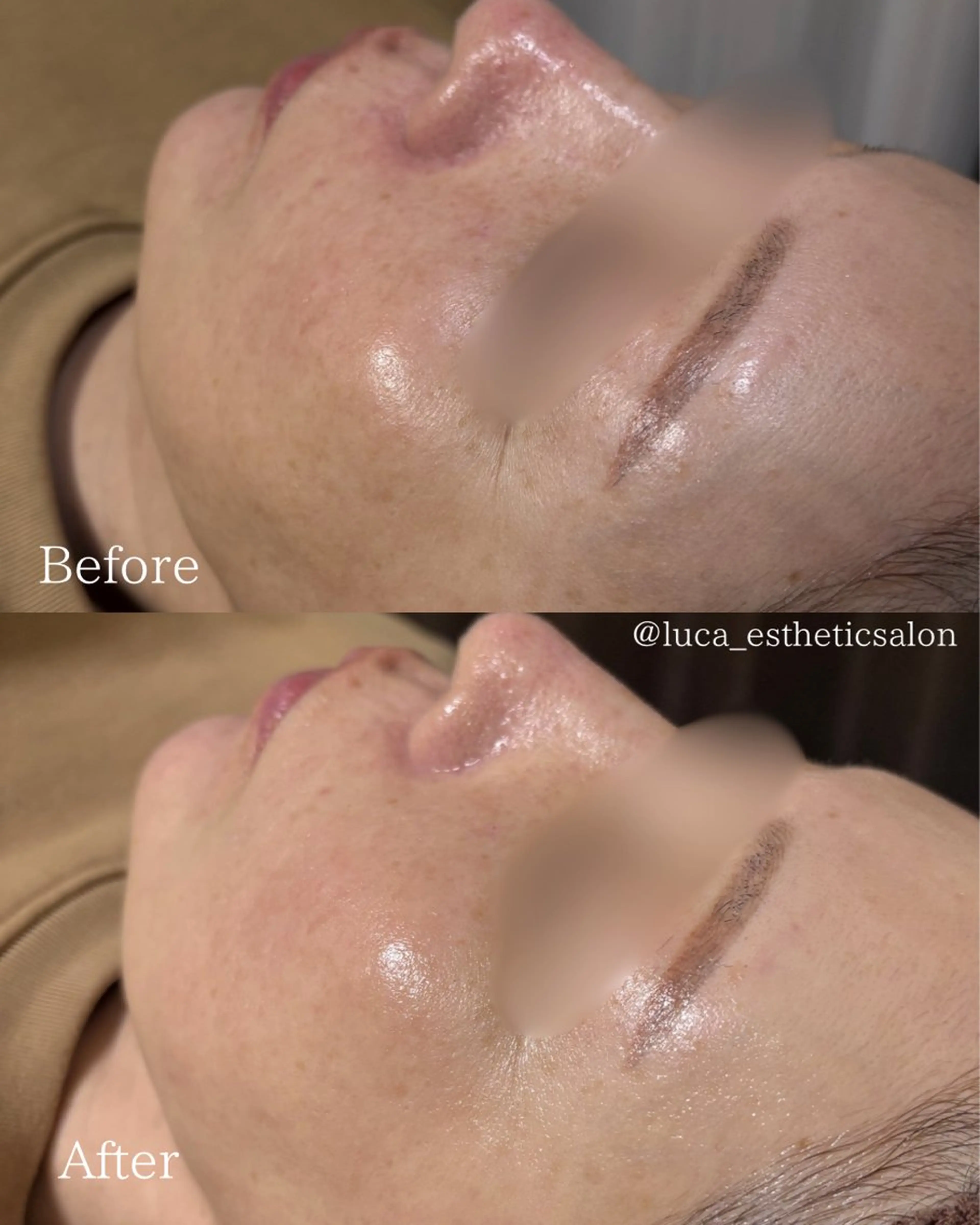 その他 Luca所属・Luca ﾙｶのエステ・リラクイメージ