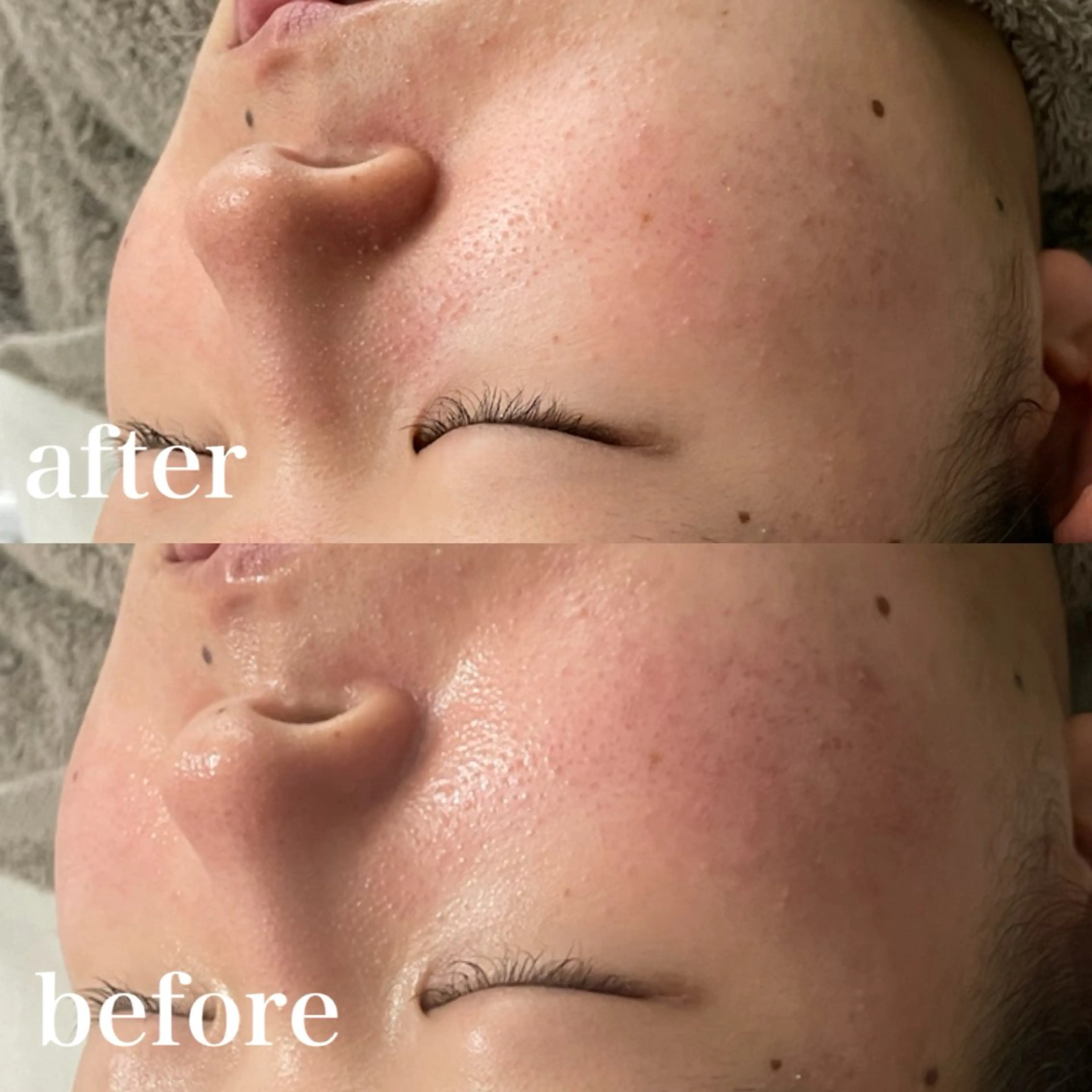 エステ ホワイトニング×肌質 改善~elエル~のその他イメージ