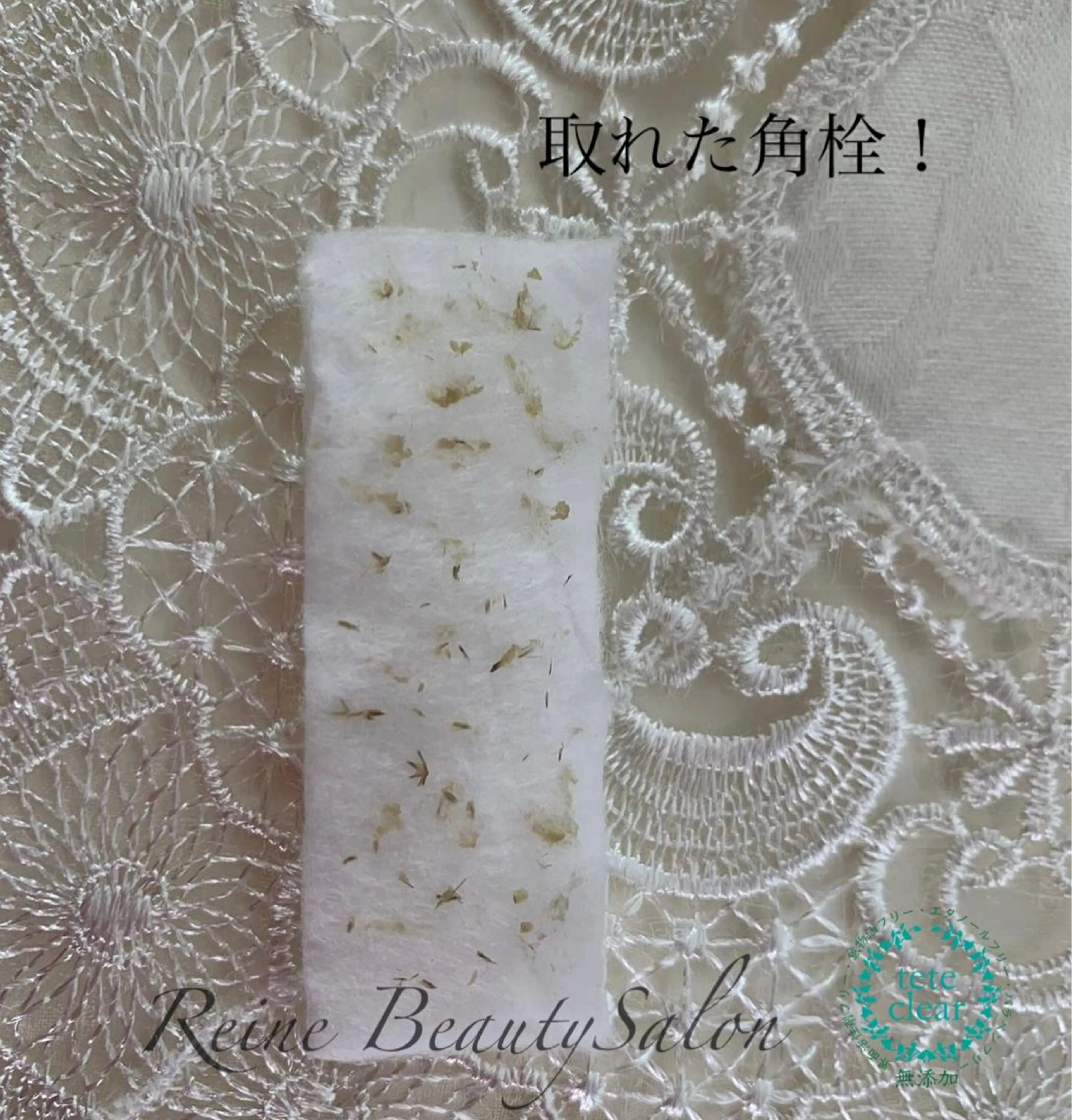 エステ Reine BeautySalon所属・毛穴/シミ肝斑/脱毛 横山梨里のエステ・リラクイメージ