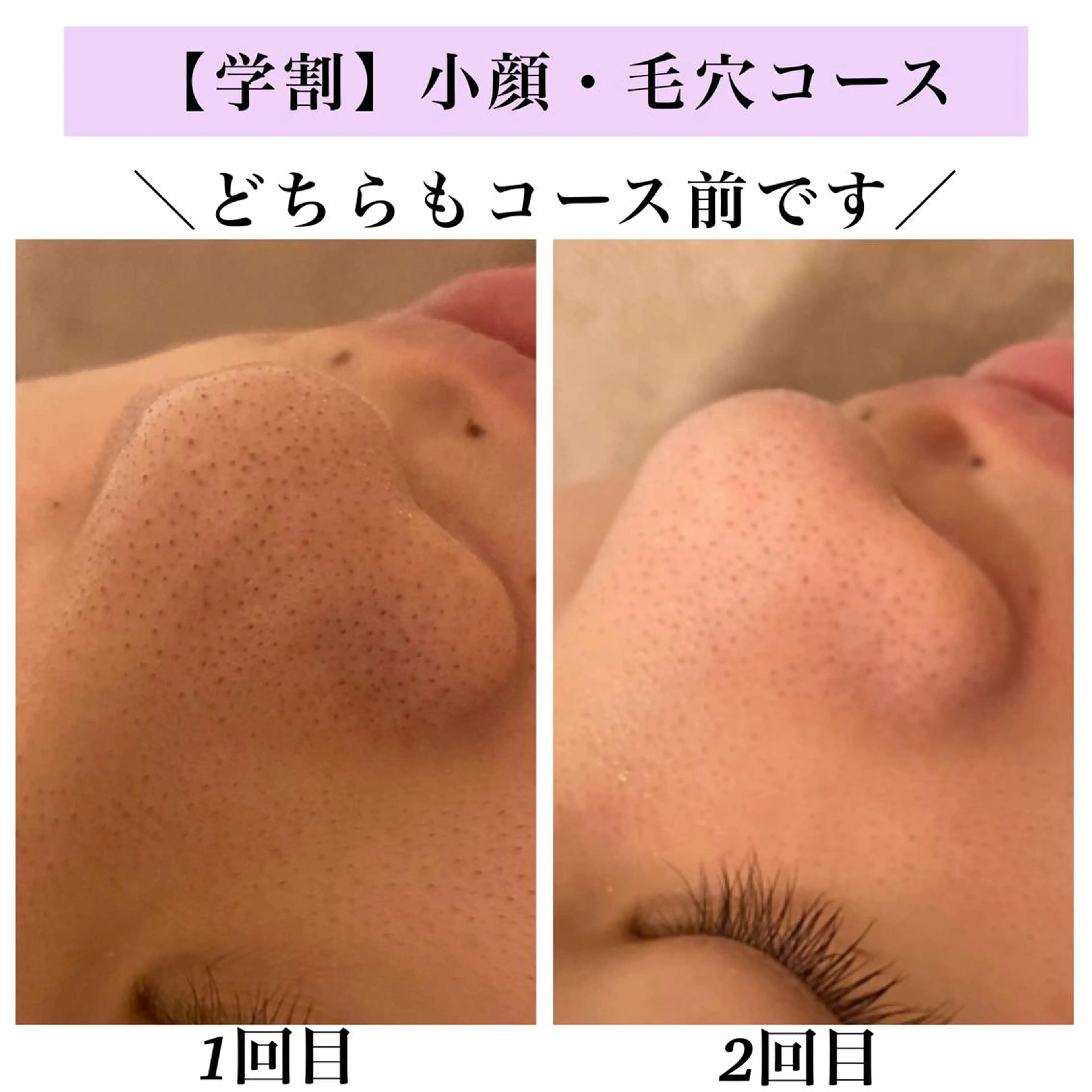 Bellesthe （ベルエステ）のエステ・リラクイメージ