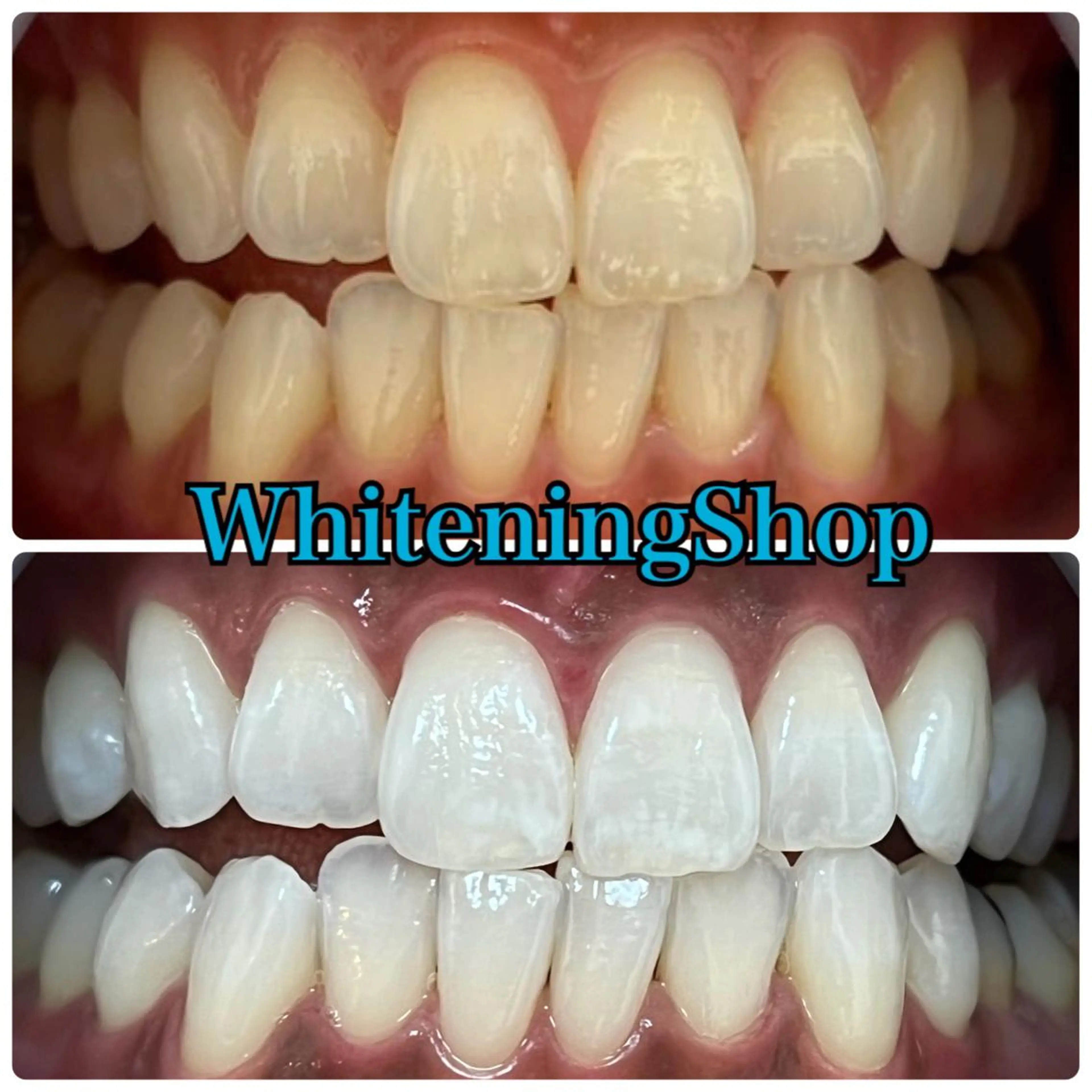 ホワイトニング ショップ吉祥寺店のエステ・リラクイメージ