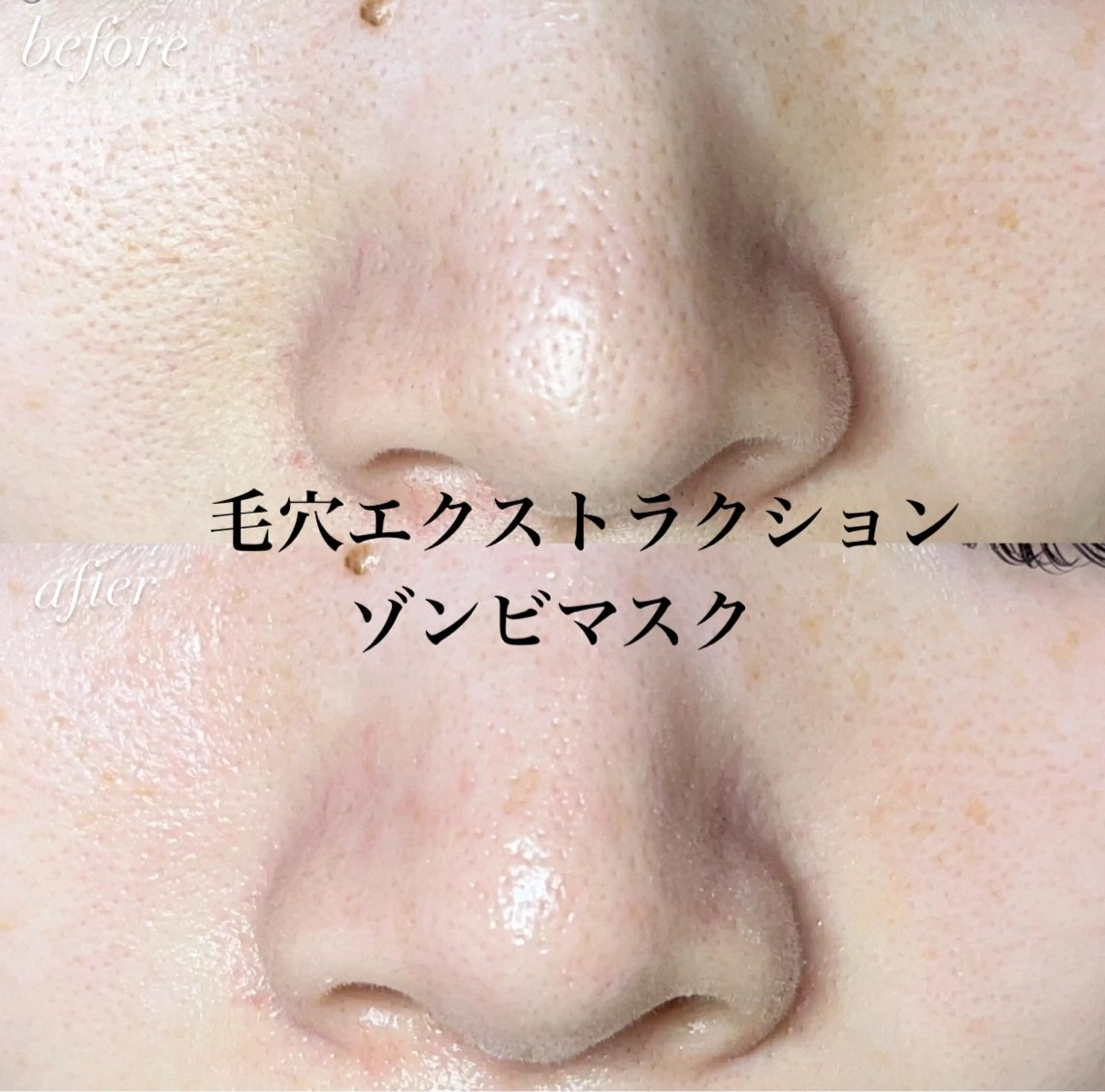 【開き毛穴にはコレ！】毛穴エクストラクション+ゾンビマスクの写真