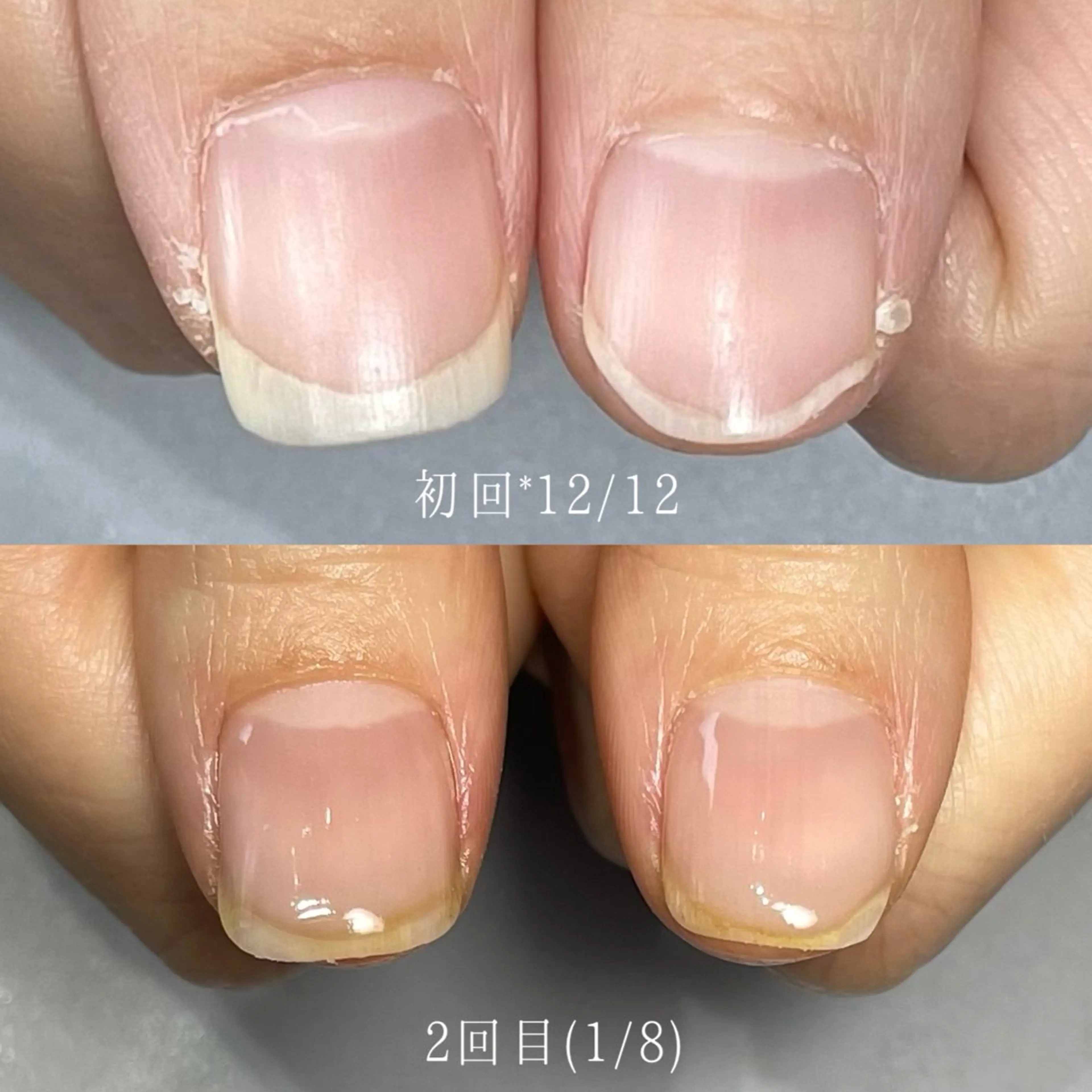 ネイル Aim* 深爪・自爪育成専門店のネイルデザイン