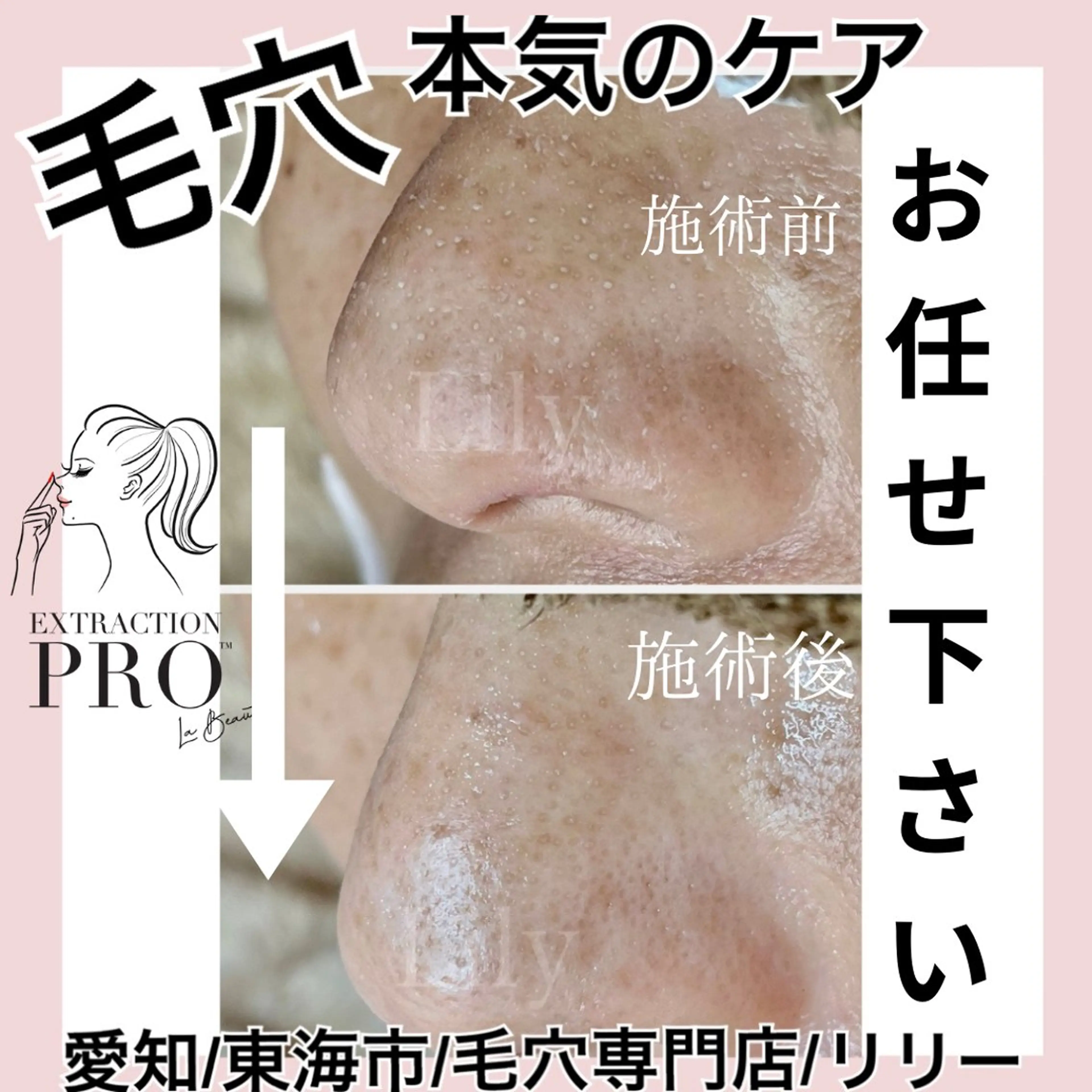 トータルビューティー サロンLilyのエステ・リラクイメージ