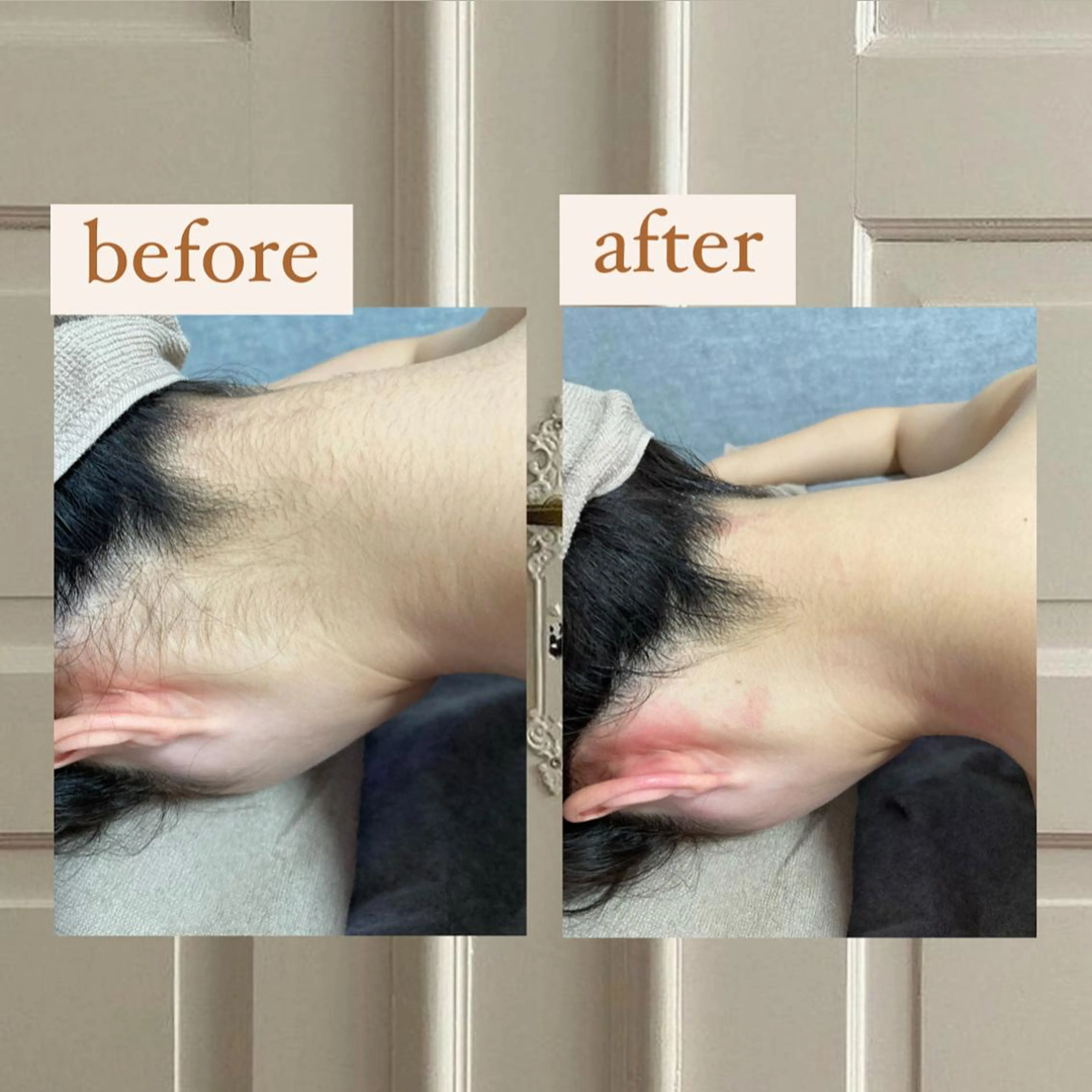 脱毛 crescent所属・【韓国肌管理・脱毛】 クレセントのその他イメージ