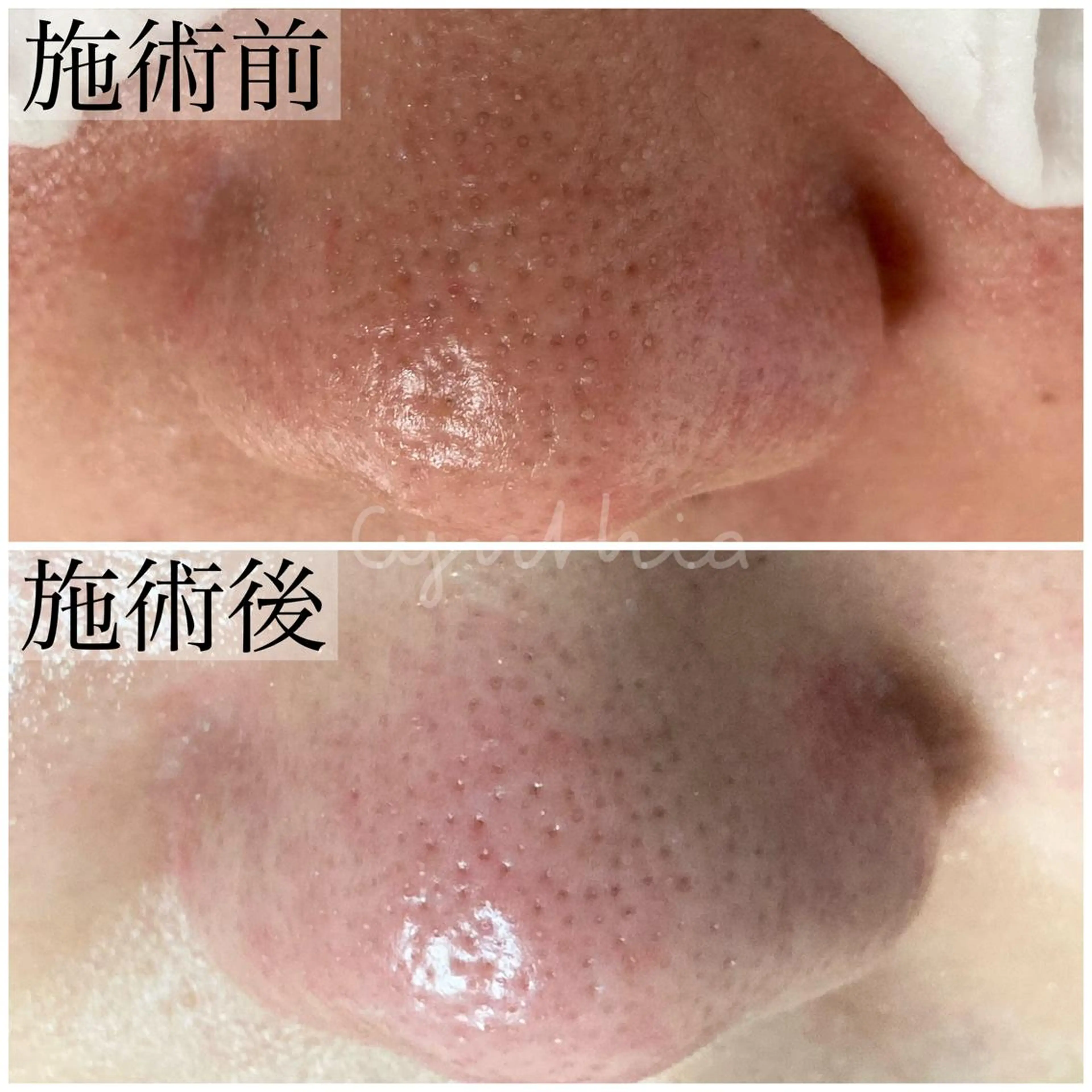 毛穴ケア専門店 Cynthiaのエステ・リラクイメージ