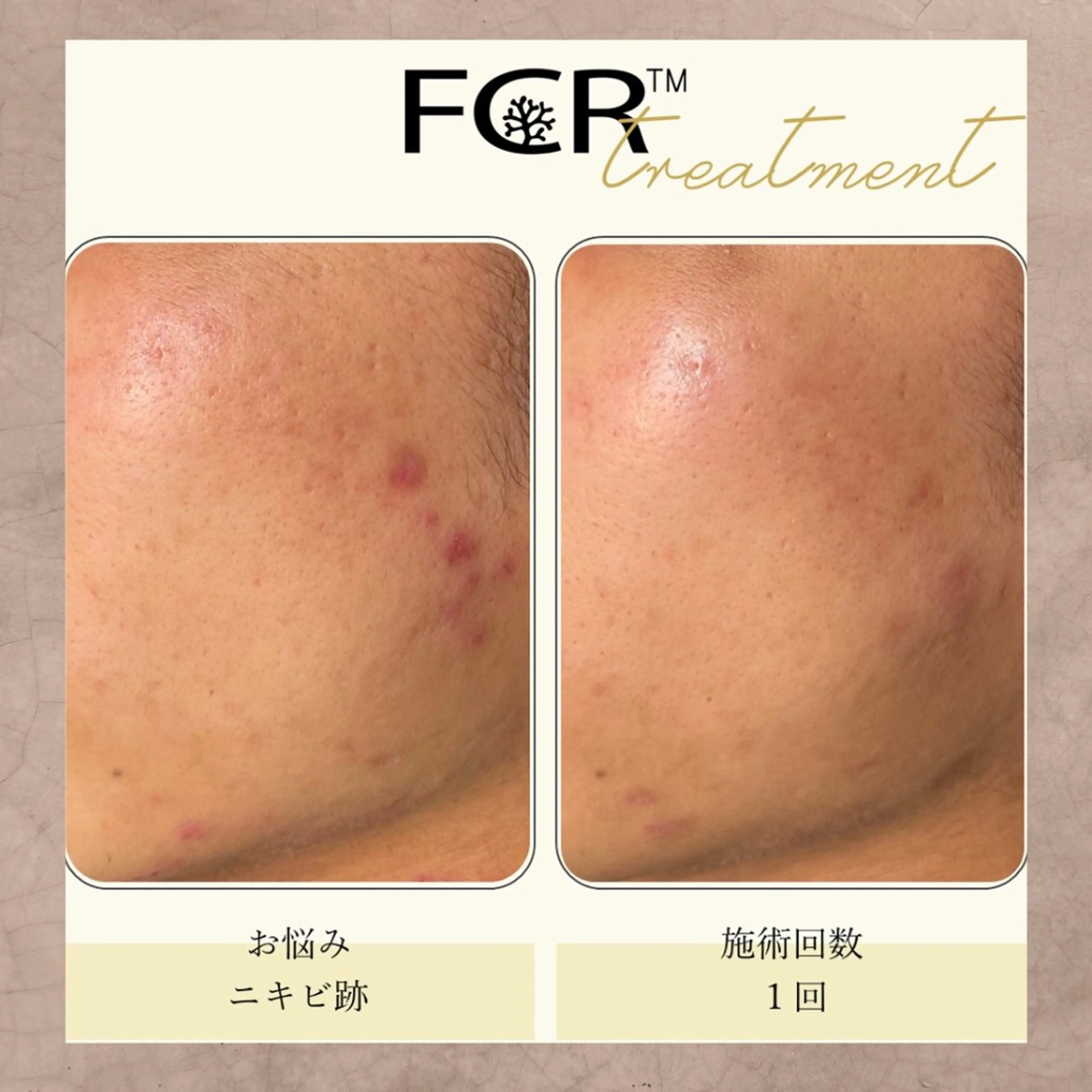 奥村 まよのエステ・リラクイメージ