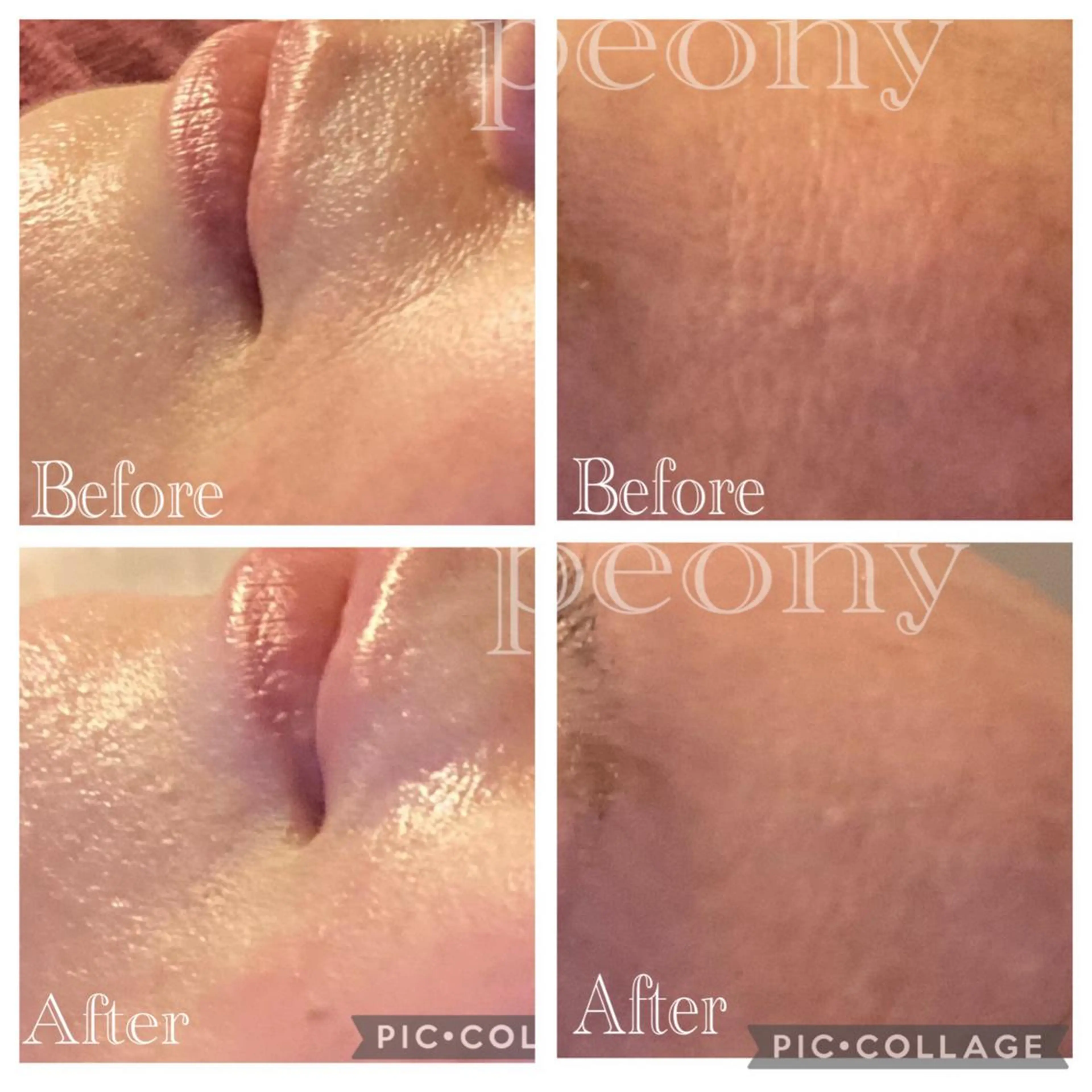 デトックス美容専門サロンｐｅｏｎｙ所属・デトックス美容専門 サロンｐｅｏｎｙのエステ・リラクイメージ