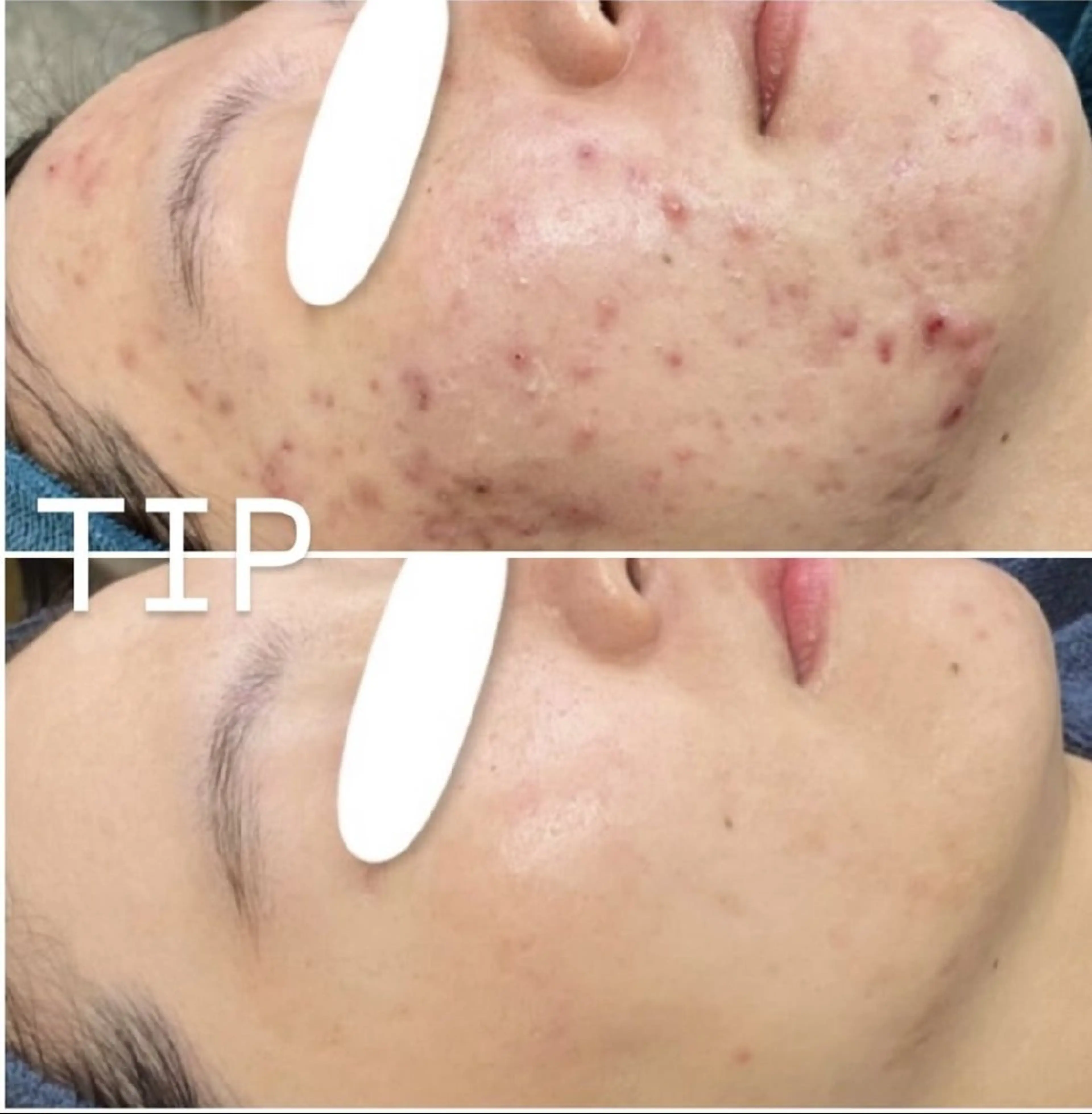 エステ Ellebeauty relaxationのエステ・リラクイメージ