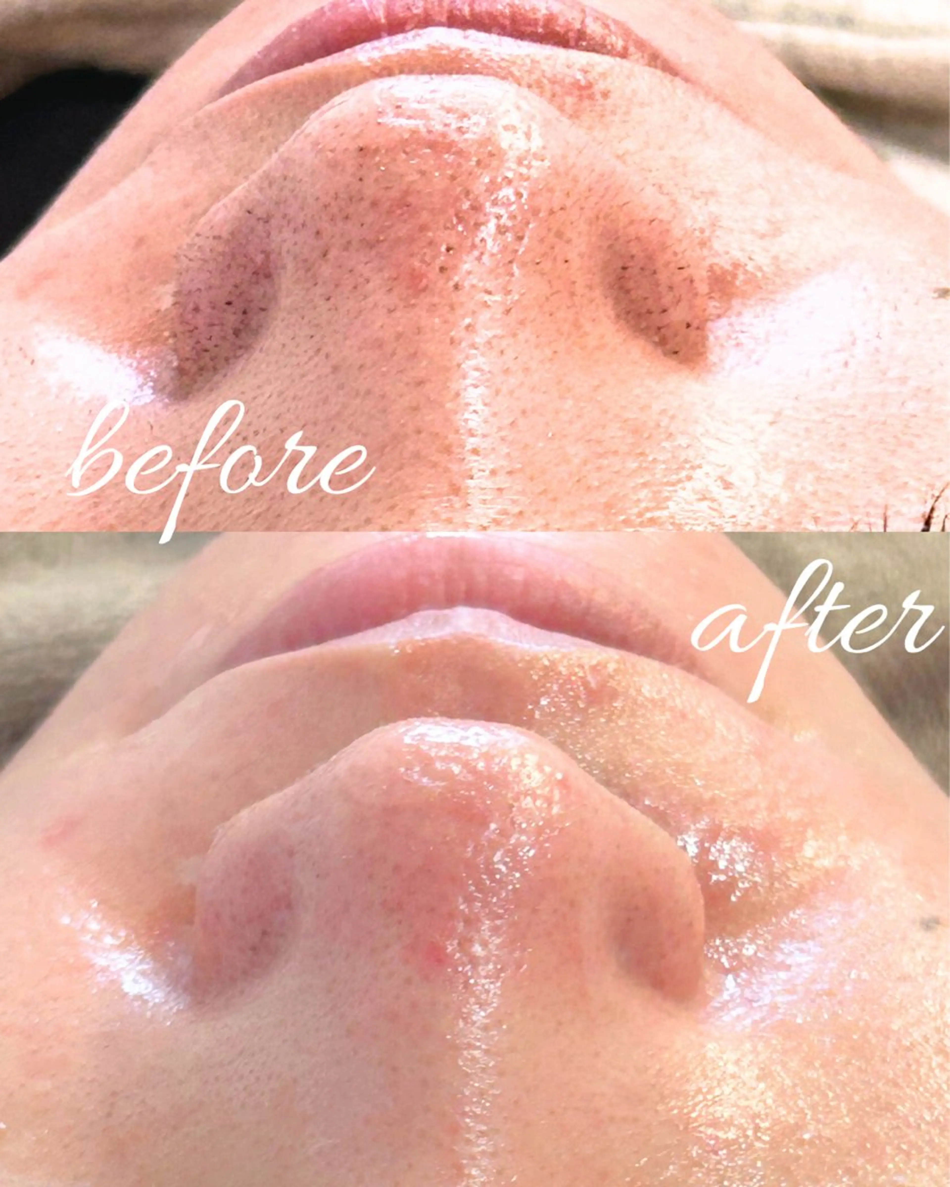 abbellina×UNO出雲塩冶店《ウノ》所属・フェイシャルエステ 🫧琉衣のエステ・リラクイメージ