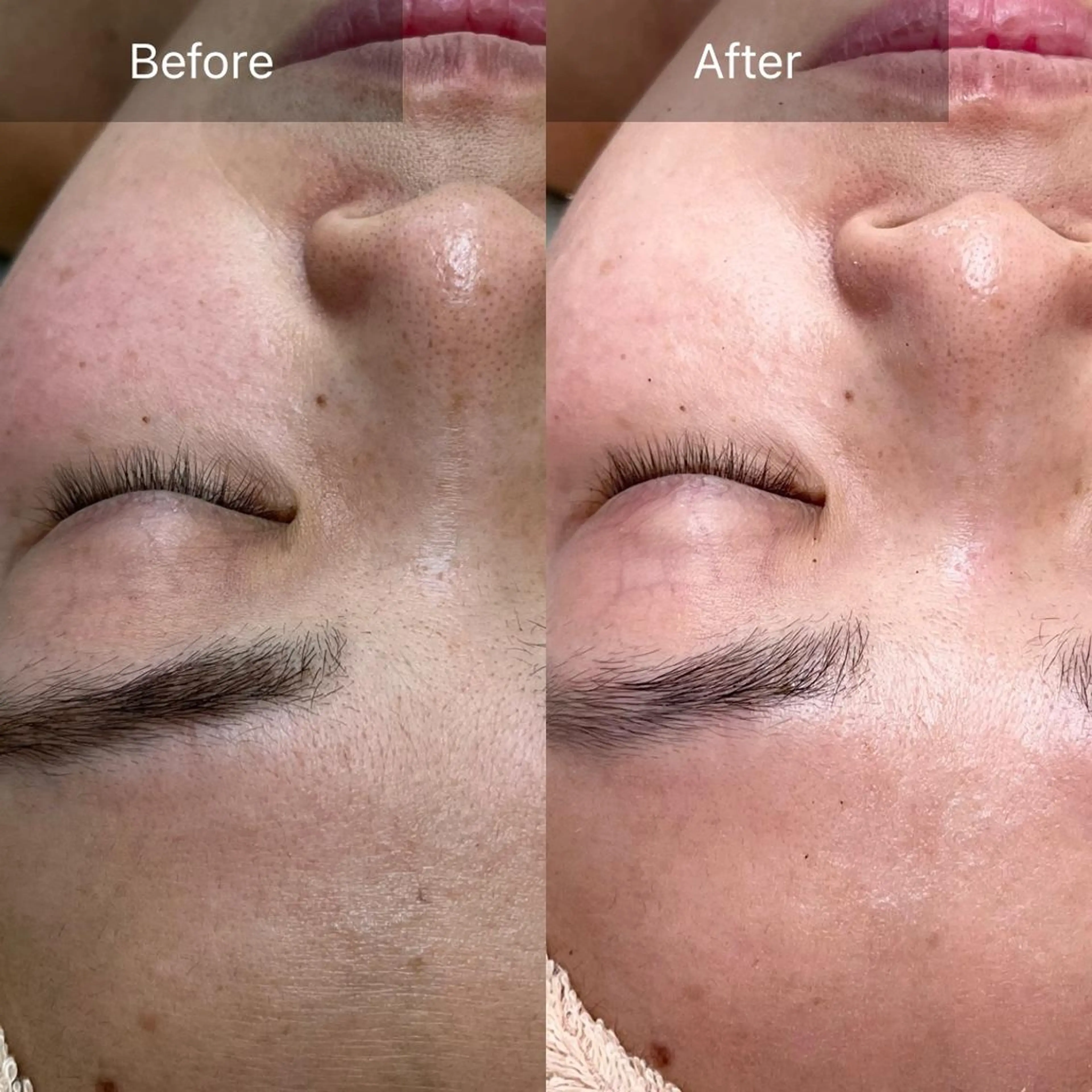 エステ Beauty Salon Ciel　Chiba所属・BeautySalo nCielChibaのエステ・リラクイメージ