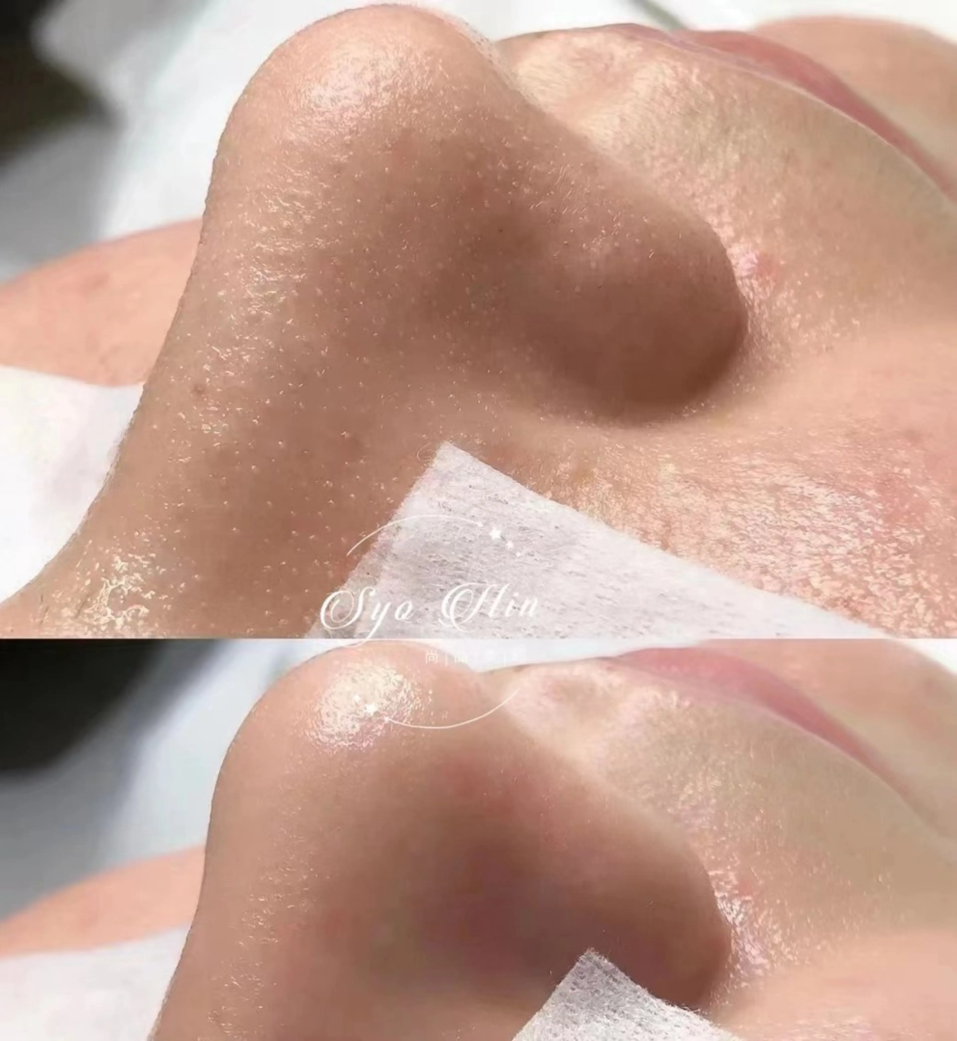 L'amour 御徒町所属・L'amour御徒町 🎀MoMo🎀のエステ・リラクイメージ