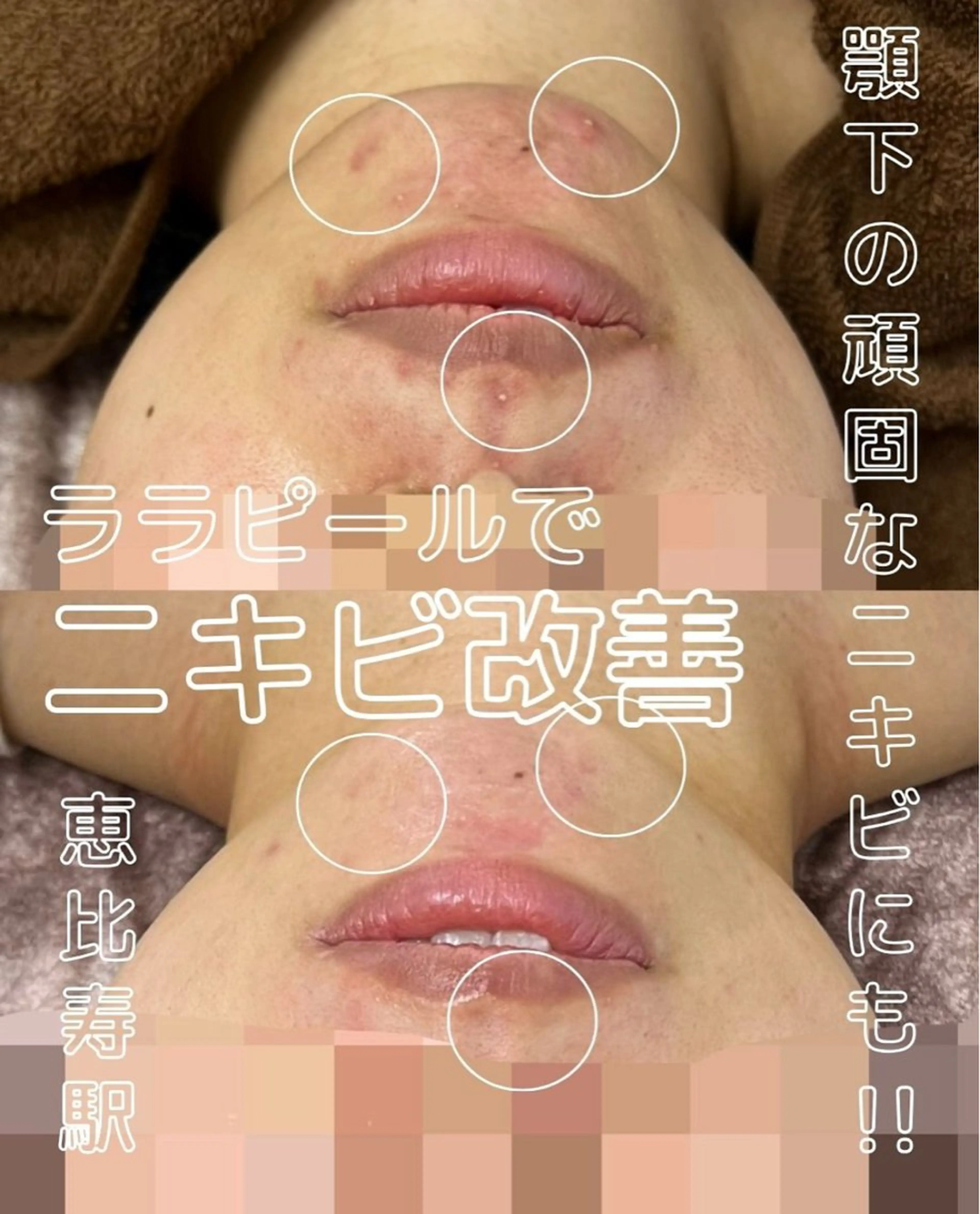 エステ 看護師が施術する ナスサロ/Emi🪽のエステ・リラクイメージ