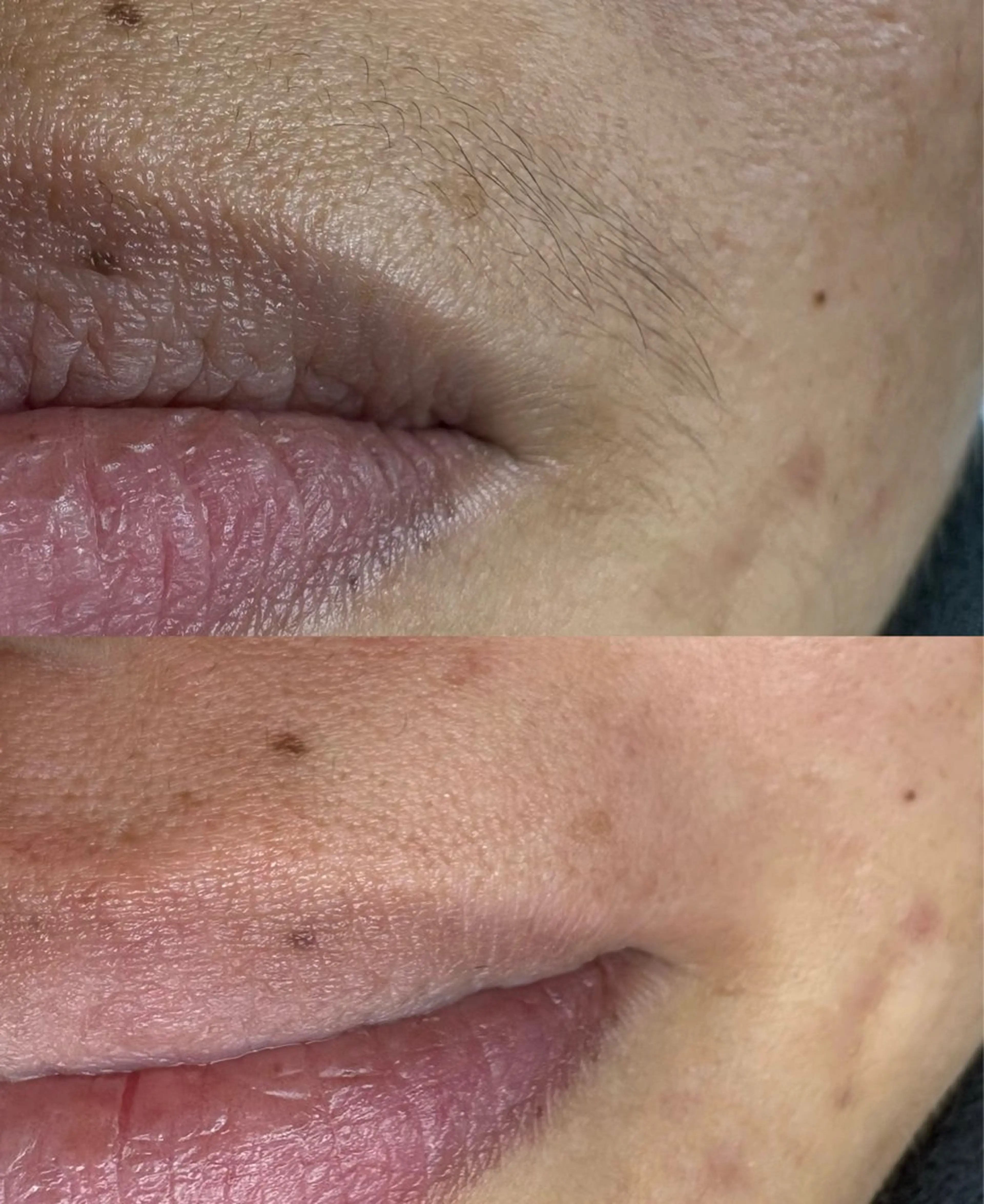 アイブロウ トータルビューティー サロン・Ｎの眉毛・アイブロウイメージ