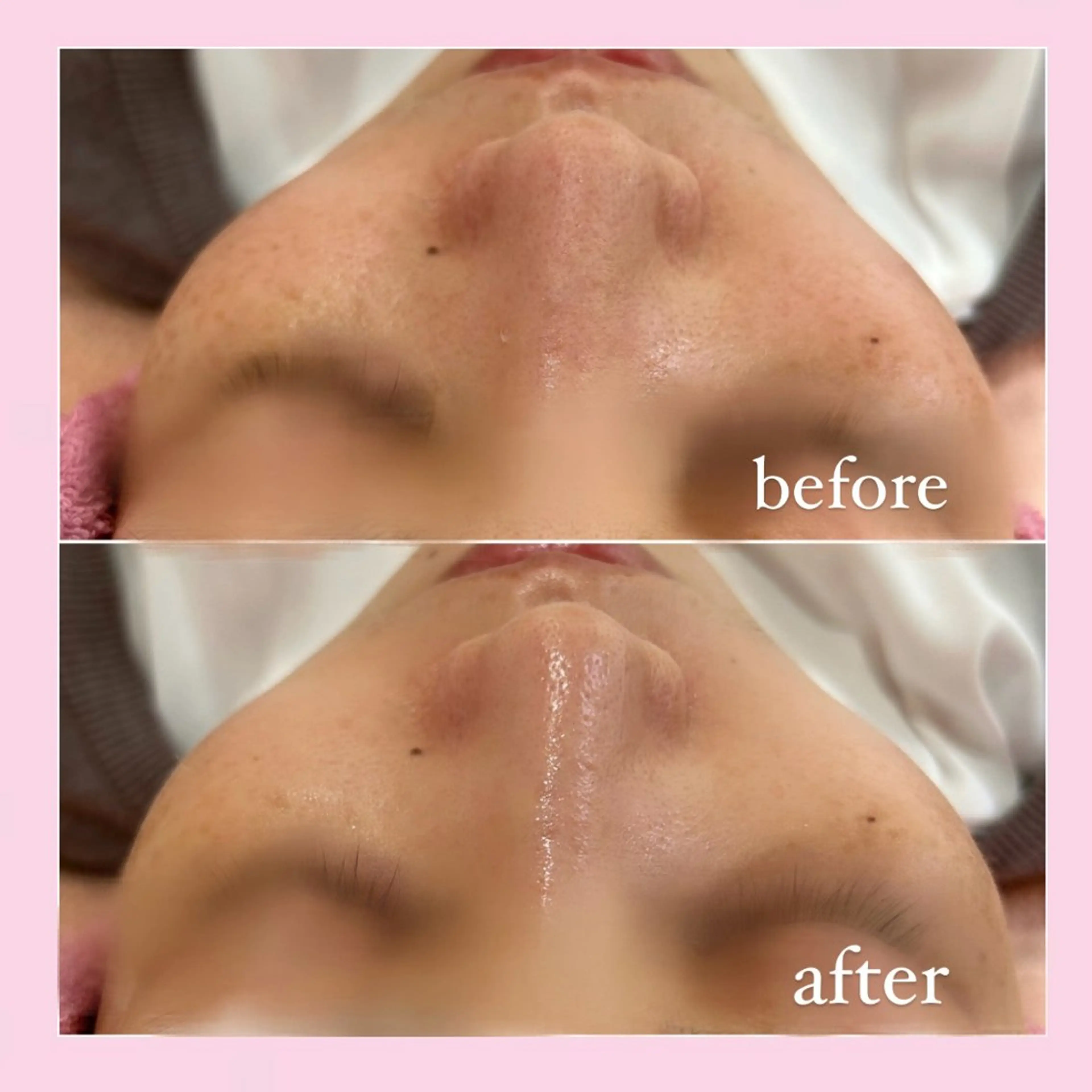 エステ 韓国肌管理専門店　White labo 宝塚店所属・有川 凜のエステ・リラクイメージ