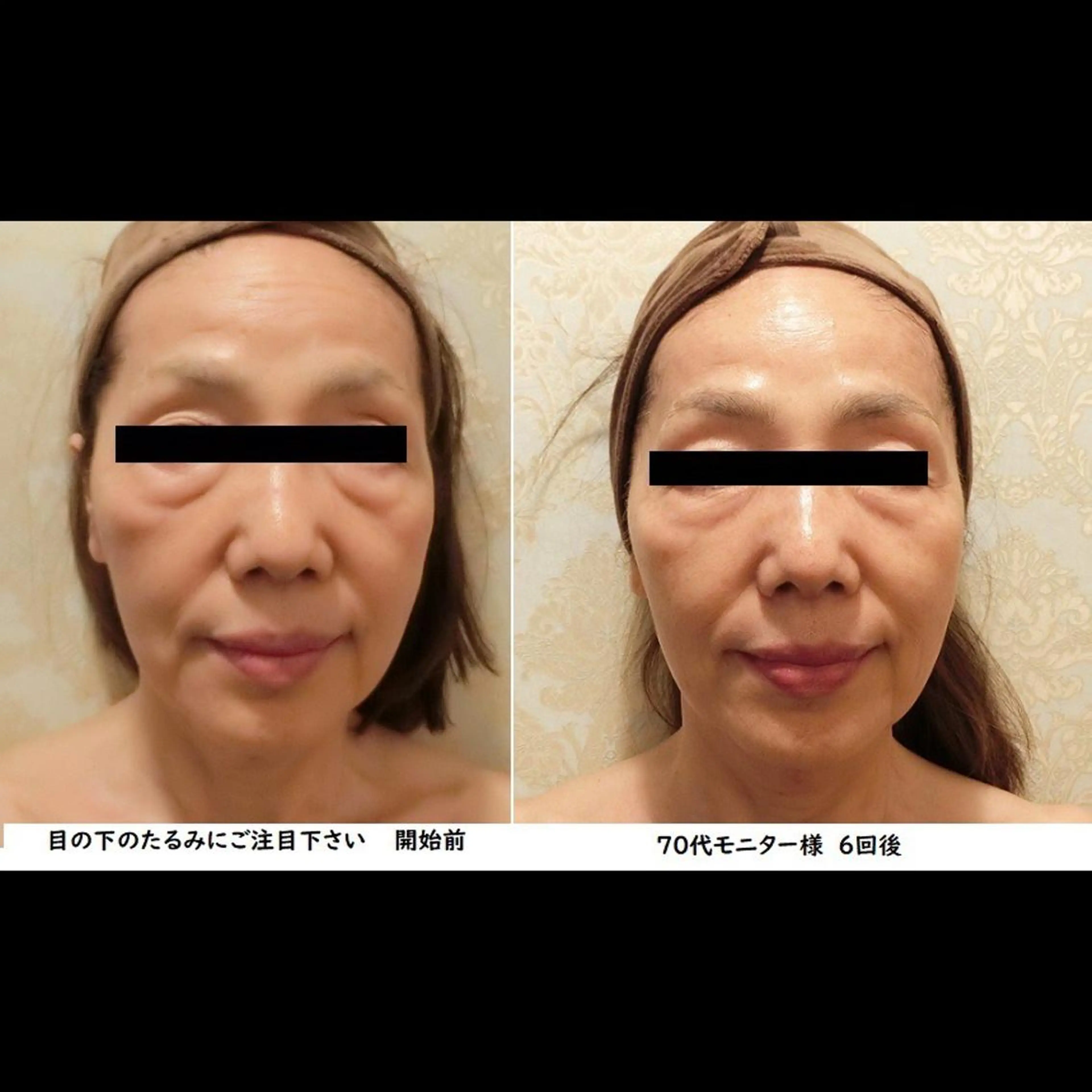 くびれ作り専門サロン こねこのシッポ虎ノ門のエステ・リラクイメージ