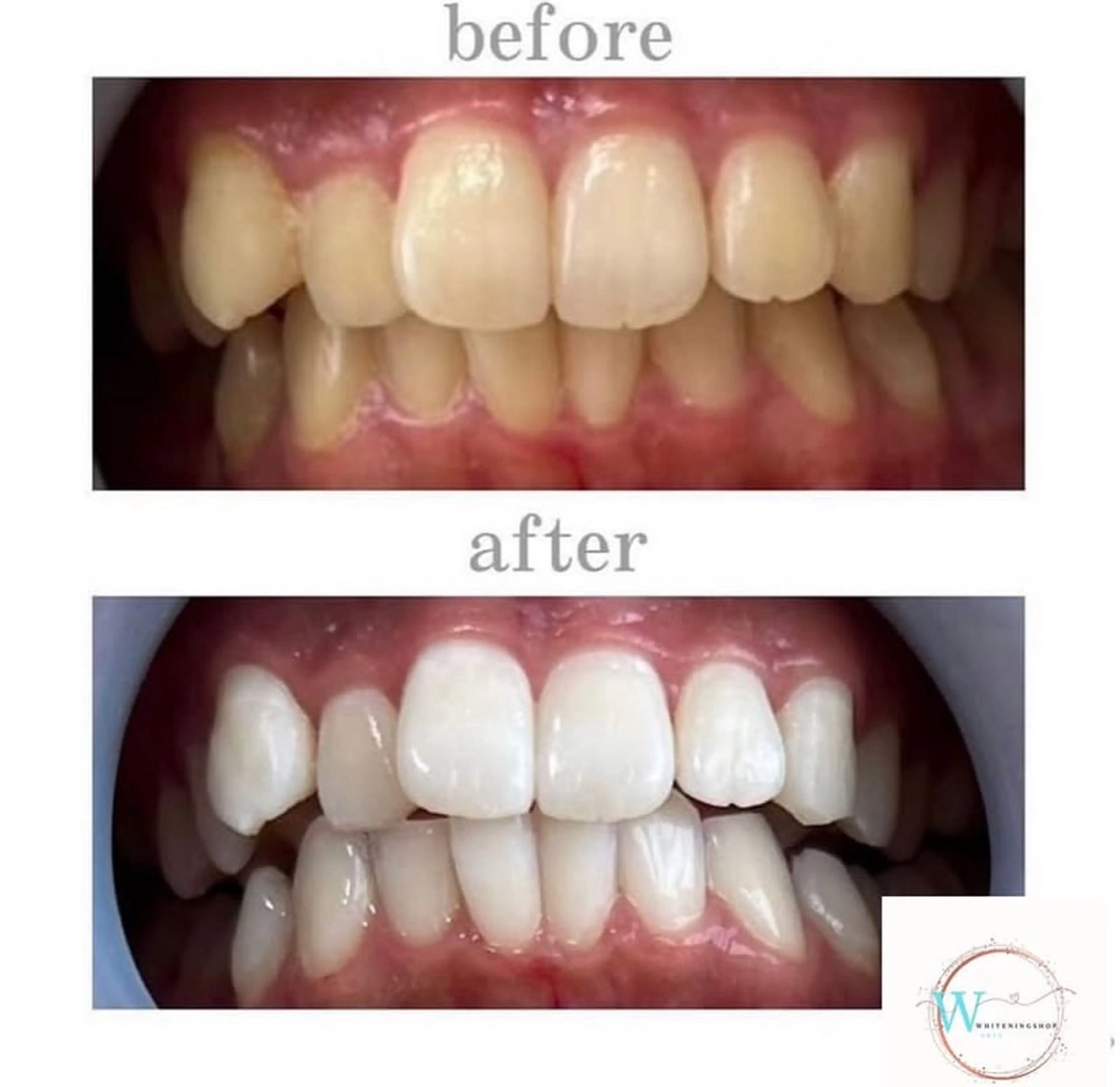 ホワイトニング ショップ本厚木のその他イメージ