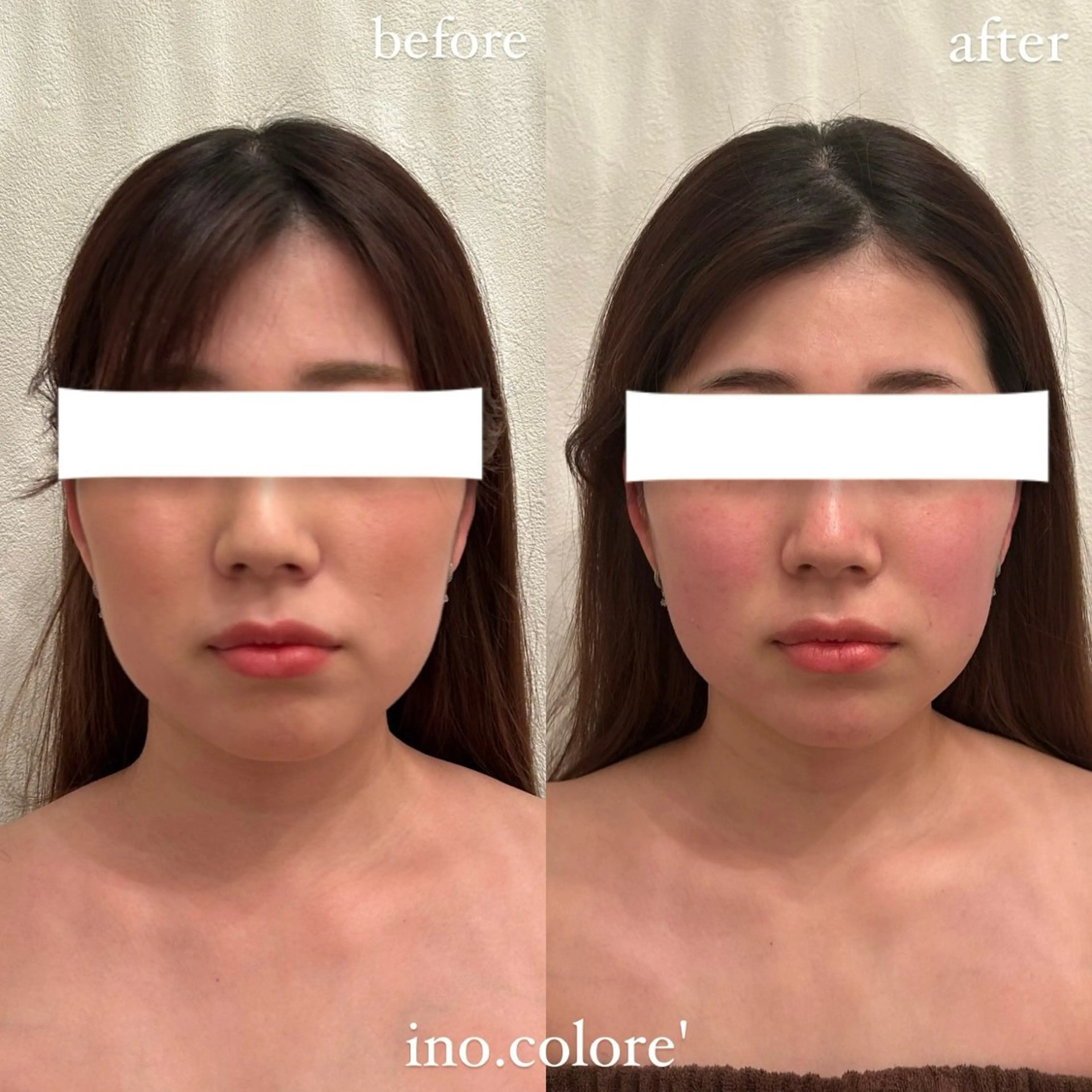 エステ リラク エステサロンino.colore'所属・小顔サロン ino.coloreのエステ・リラクイメージ