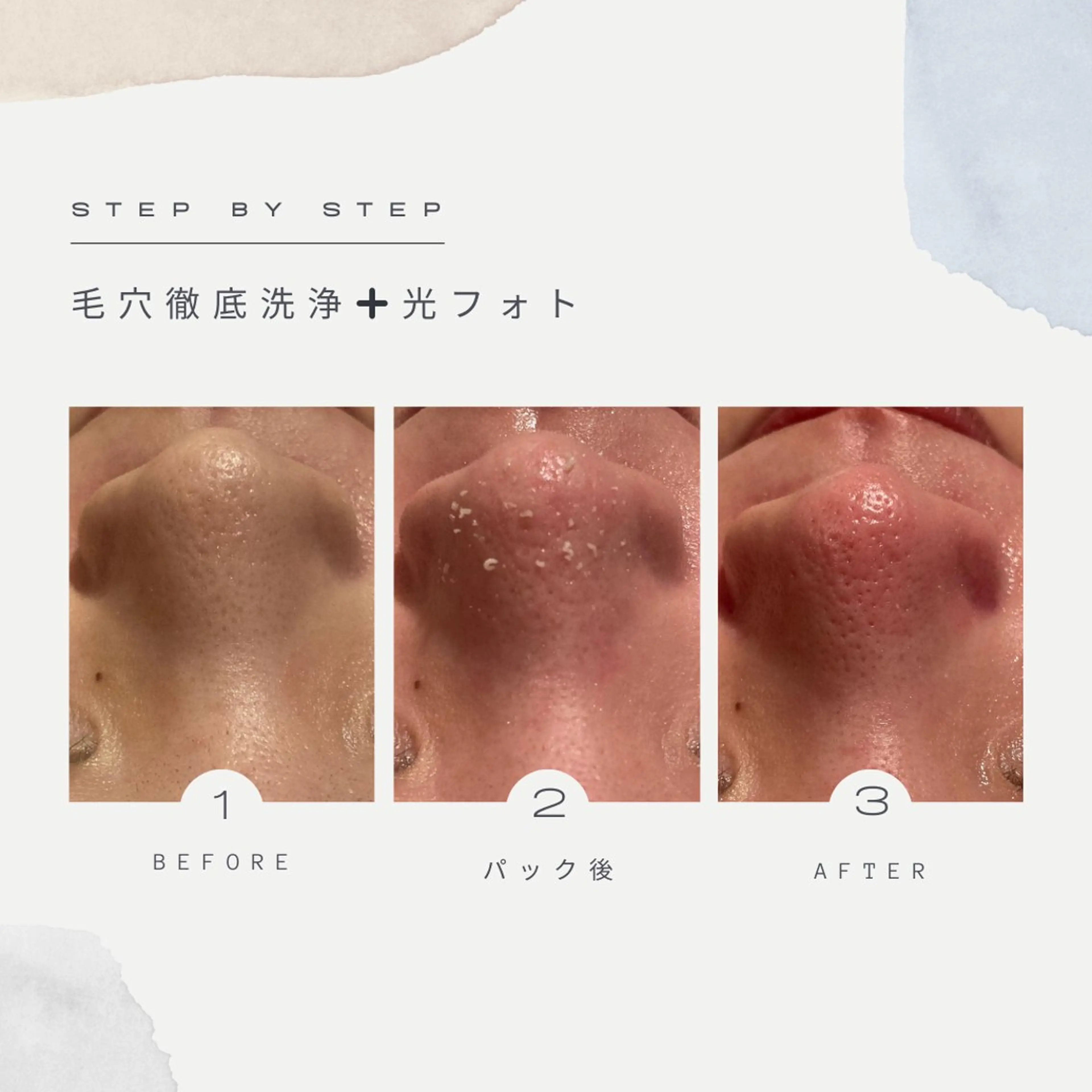 INFINITY 神戸店のエステ・リラクイメージ