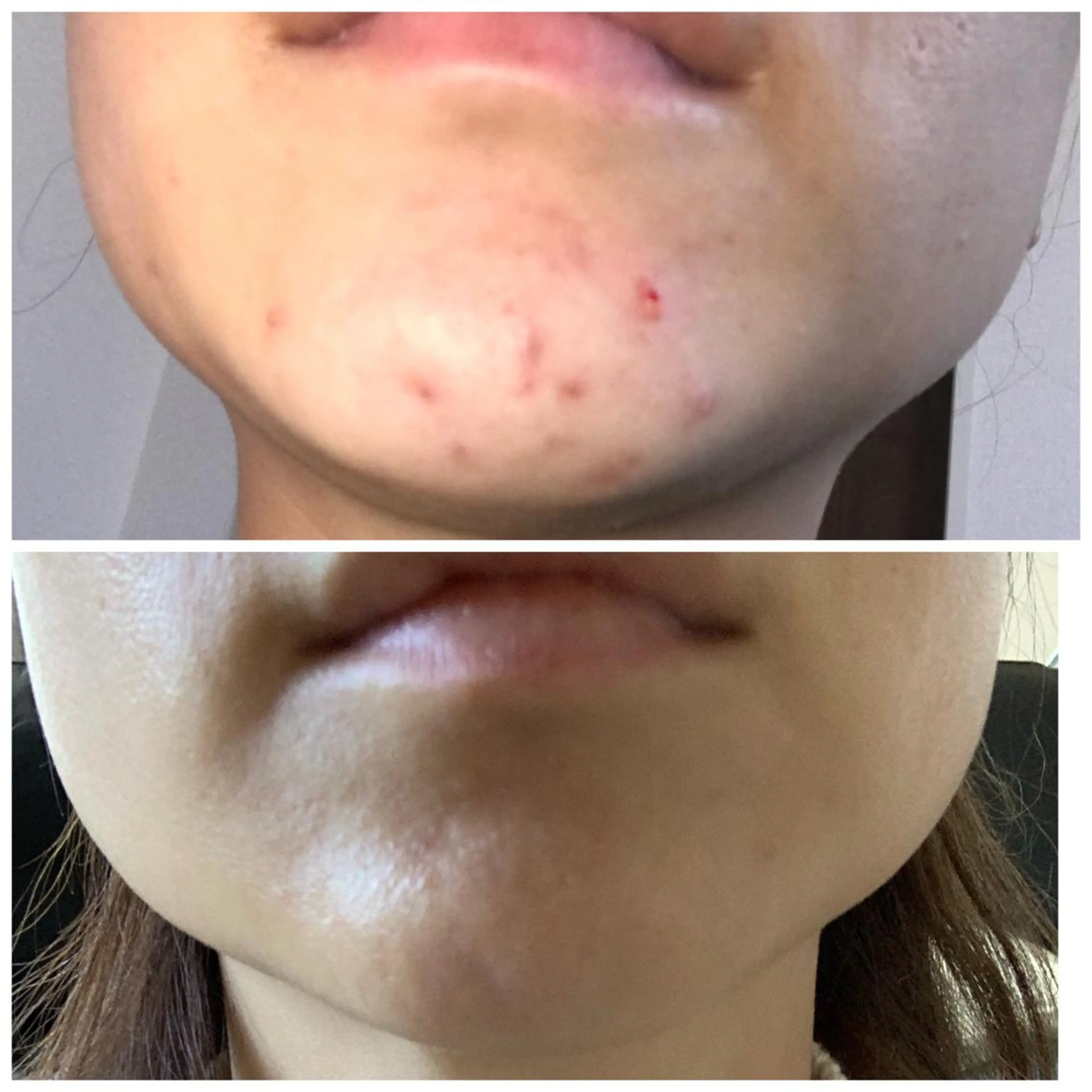 エステ 食べながら魅せボディ éclatJua川越のエステ・リラクイメージ