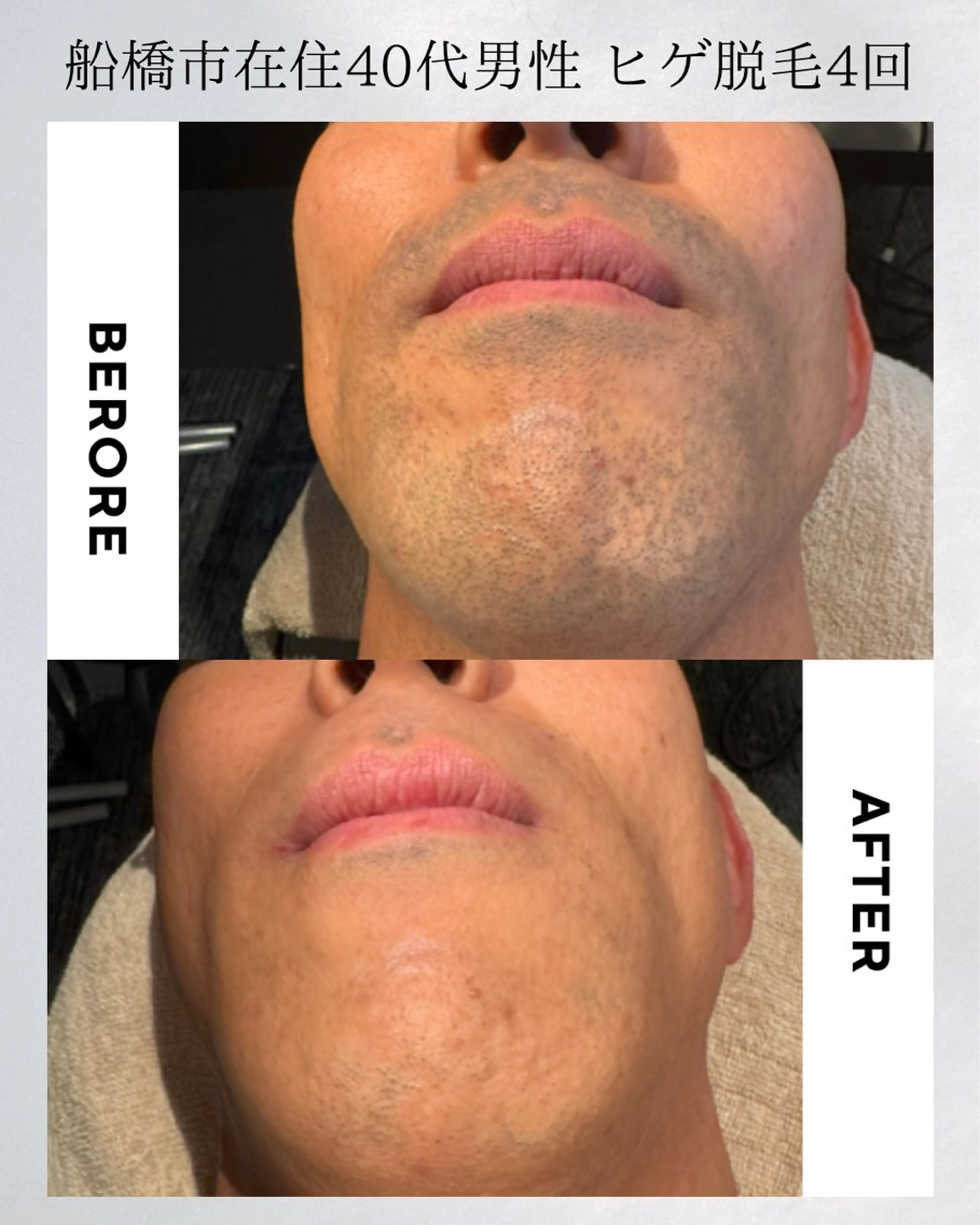 都度払いメンズGents.FUNABASHI 東船橋店所属・東船橋メンズ脱毛 ジェンツ船橋のエステ・リラクイメージ