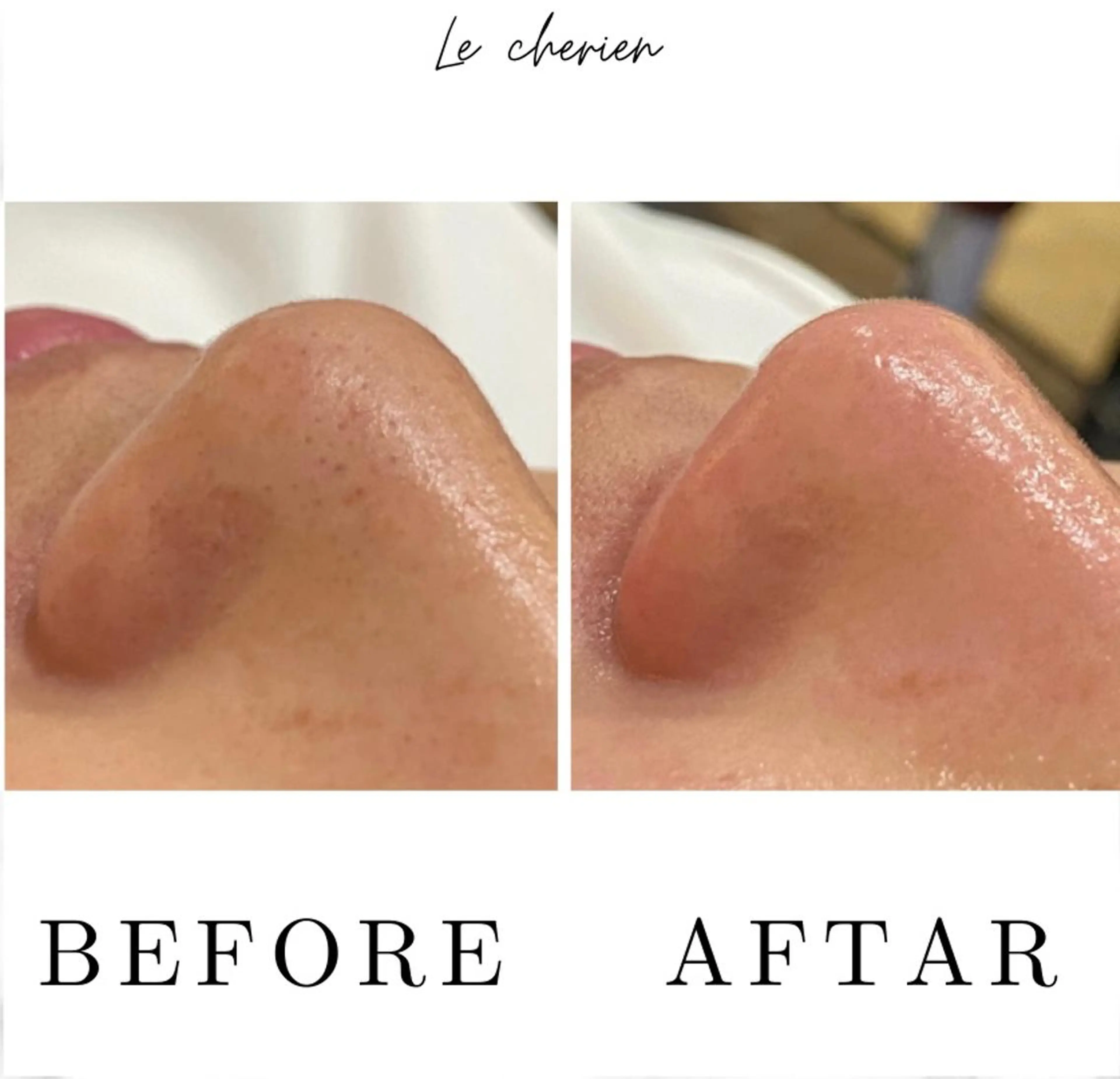 Le  cherien ル シェリア所属・毛穴洗浄/ハイフ サロンのエステ・リラクイメージ